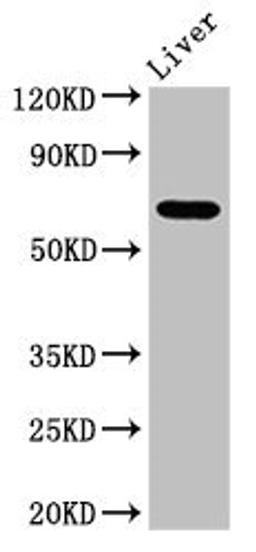 Western Blot. Positive WB detected in: Mouse liver tissue. All lanes: SENP2 antibody at 3.4ug/ml. Secondary. Goat polyclonal to rabbit IgG at 1/50000 dilution. Predicted band size: 68, 67 kDa. Observed band size: 68 kDa.