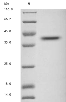 (Tris-Glycine gel) Discontinuous SDS-PAGE (reduced) with 5% enrichment gel and 15% separation gel.