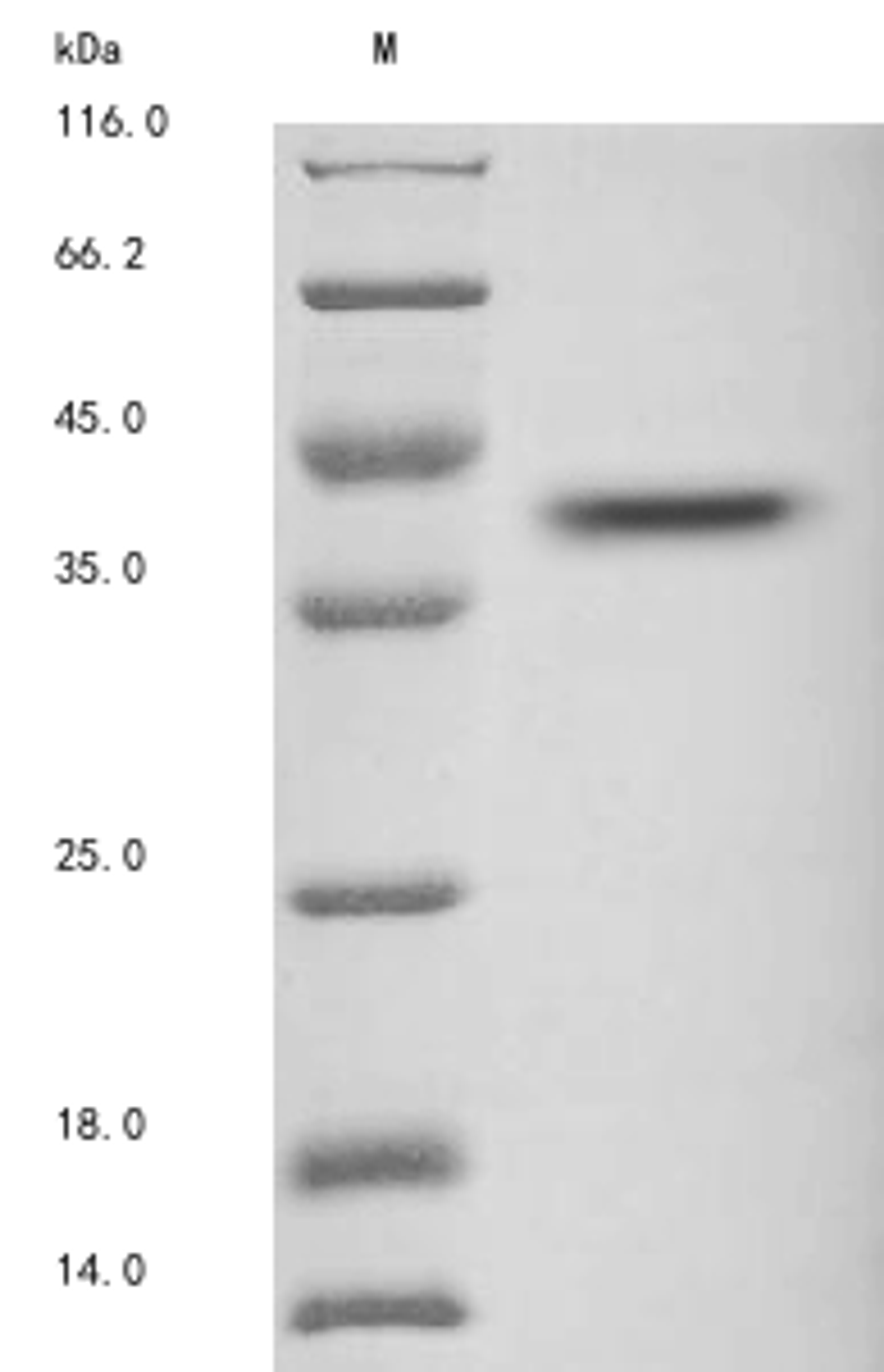 (Tris-Glycine gel) Discontinuous SDS-PAGE (reduced) with 5% enrichment gel and 15% separation gel.
