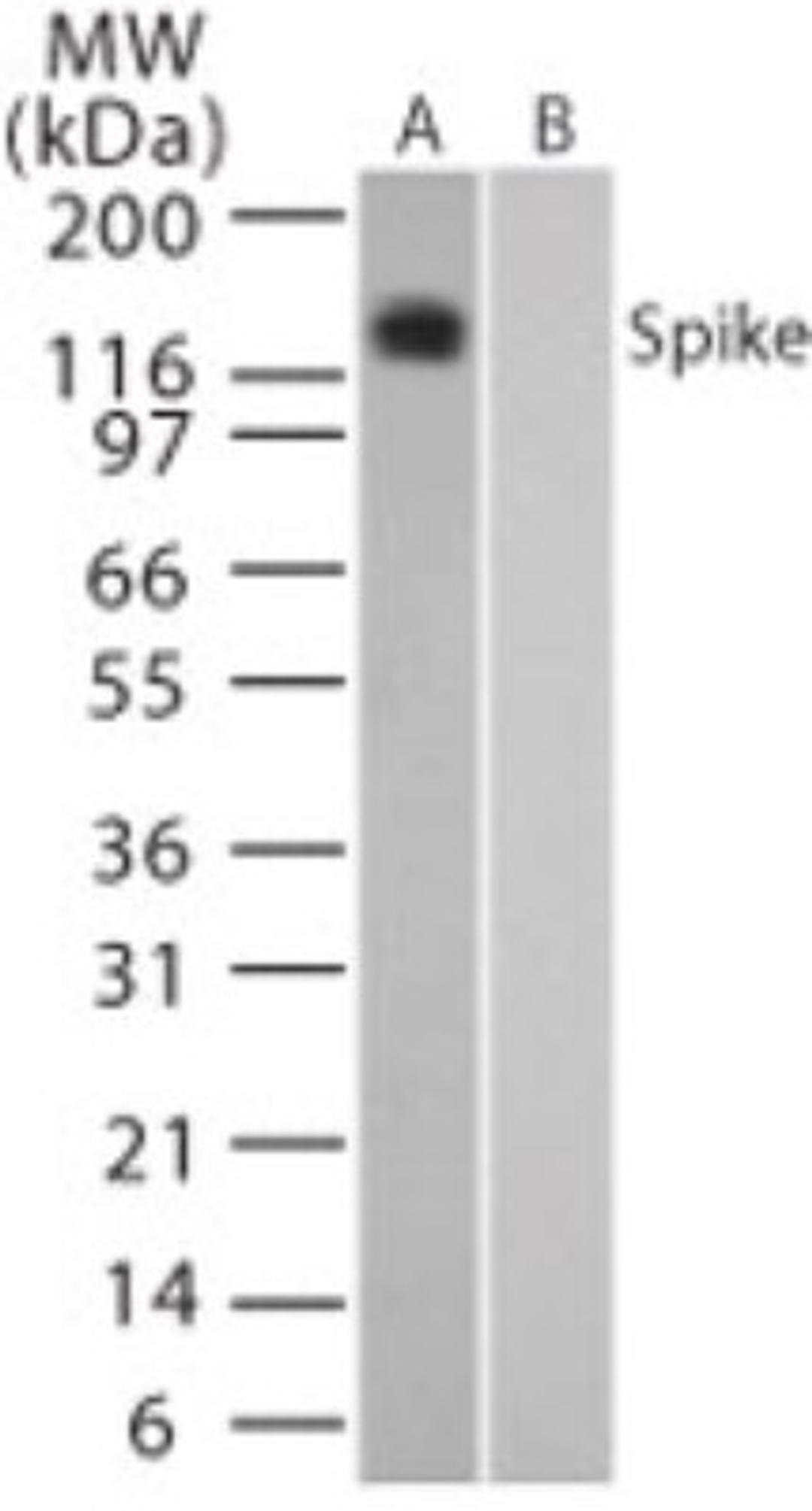 Western Blot: Sars Spike Protein Antibody [NB100-56578] - analysis of Spike in (A) transfected and (B) untransfected mouse melanoma cell lysate using this antibody. 05 ug/ml.