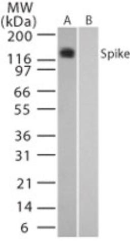 Western Blot: Sars Spike Protein Antibody [NB100-56578] - analysis of Spike in (A) transfected and (B) untransfected mouse melanoma cell lysate using this antibody. 05 ug/ml.