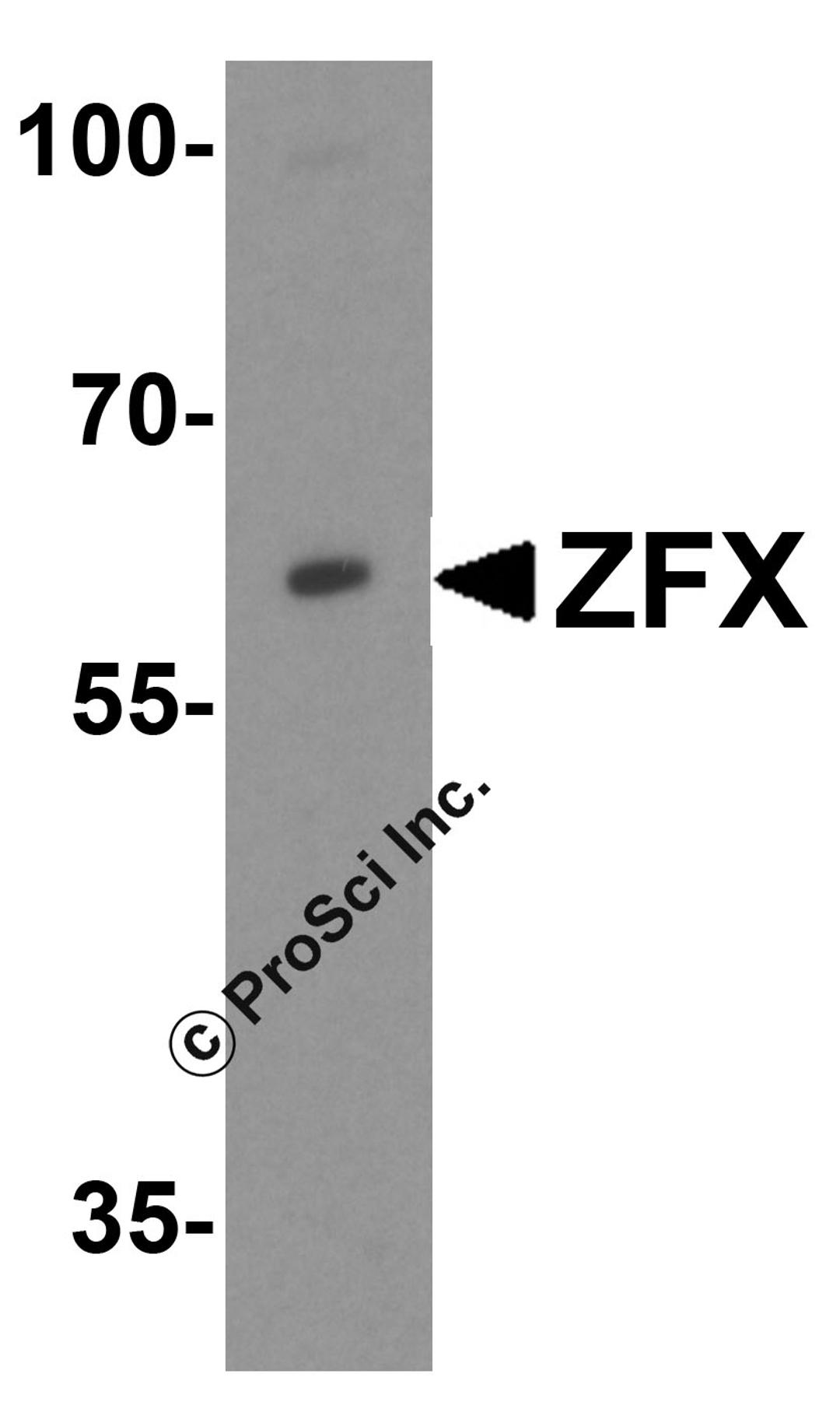 Western blot analysis of ZFX in Daudi cell lysate with ZFX antibody at 1 μg/mL.