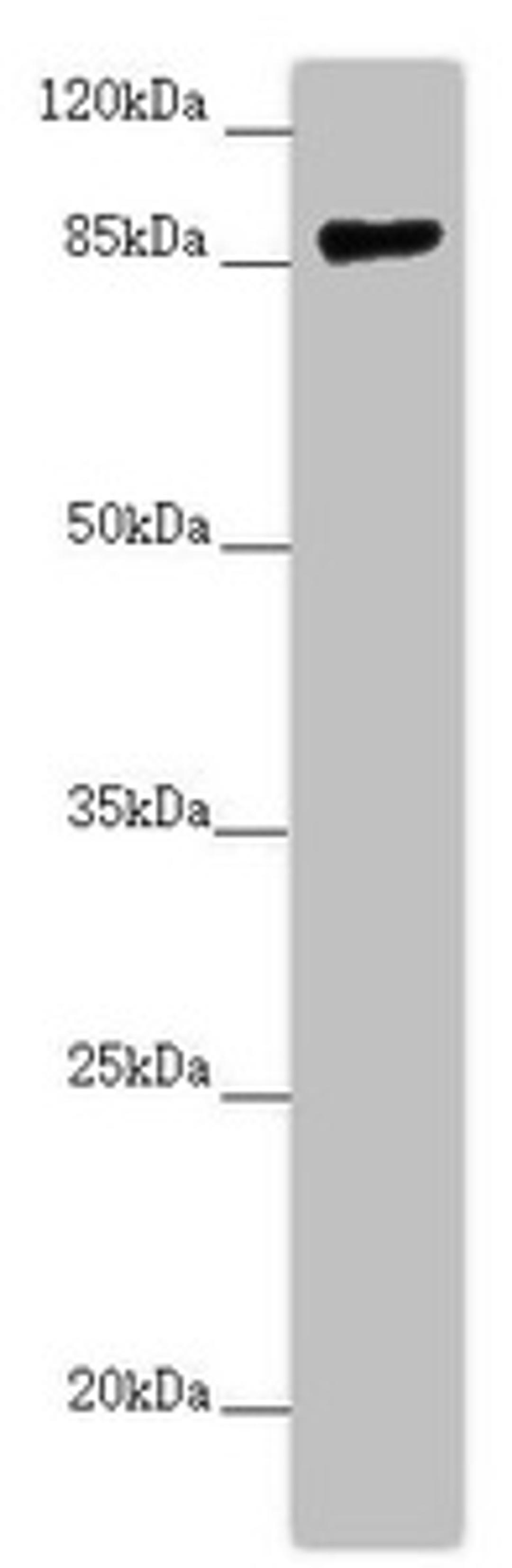 Western blot. All lanes: CCHCR1 antibody at 2.67 ug/ml + 293T whole cell lysate. Secondary. Goat polyclonal to rabbit IgG at 1/10000 dilution. Predicted band size: 89, 100, 96 kDa. Observed band size: 89 kDa.