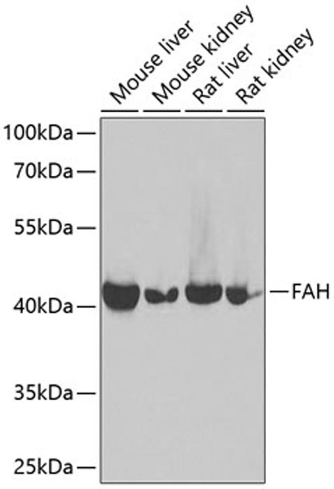 Western blot - FAH antibody (A13492)