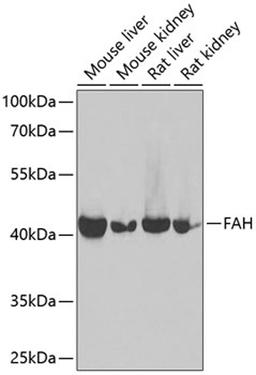 Western blot - FAH antibody (A13492)