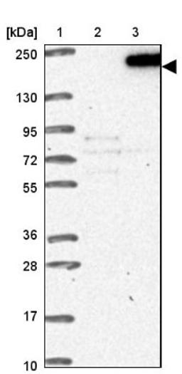 Western Blot: ANKRD15 Antibody [NBP1-90167] - Lane 1: Marker [kDa] 250, 130, 95, 72, 55, 36, 28, 17, 10<br/>Lane 2: Negative control (vector only transfected HEK293T lysate)<br/>Lane 3: Over-expression lysate (Co-expressed with a C-terminal myc-DDK tag (~3.1 kDa) in mammalian HEK293T cells, LY407129)