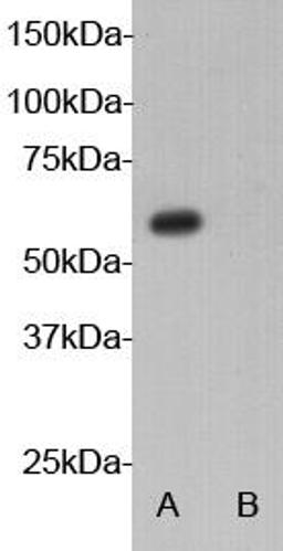 Western Blot analysis of 293 cell transfected (lane A) and not transfected (lane B) with AIRE gene using Autoimmune regulator antibody