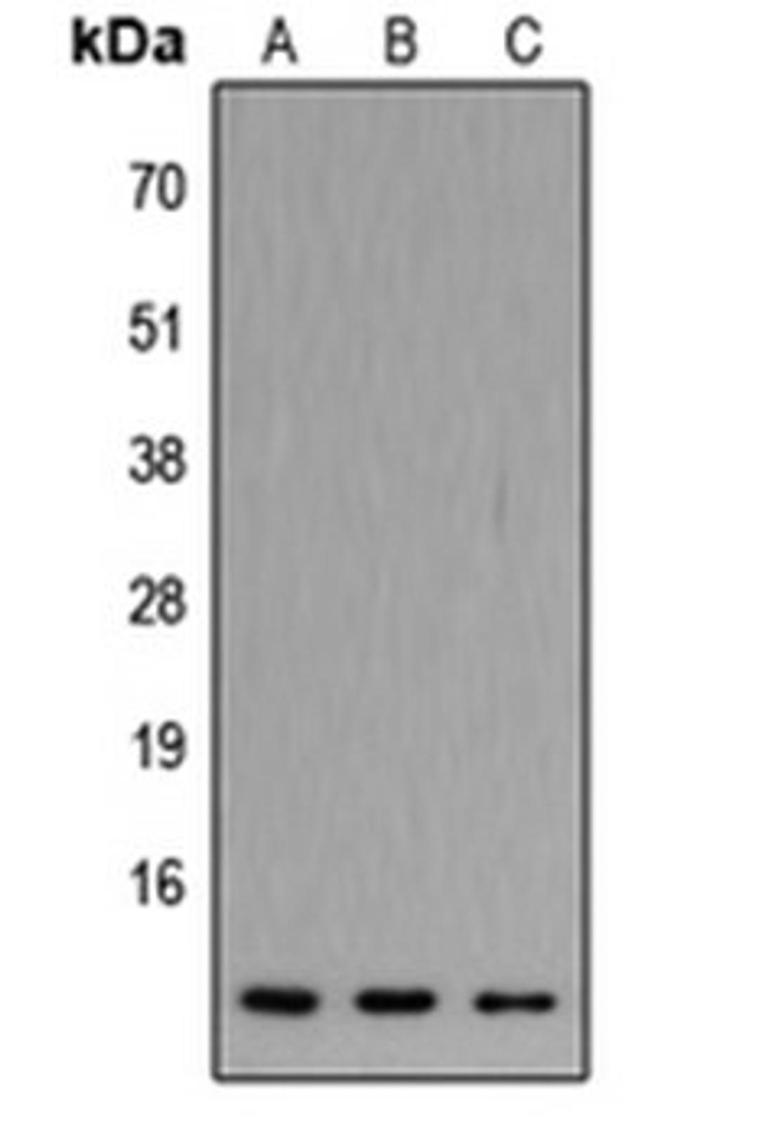 Western blot analysis of HEK293T (Lane 1), Raw264.7 (Lane 2), H9C2 (Lane 3) whole cell lysates using ATP5JL antibody