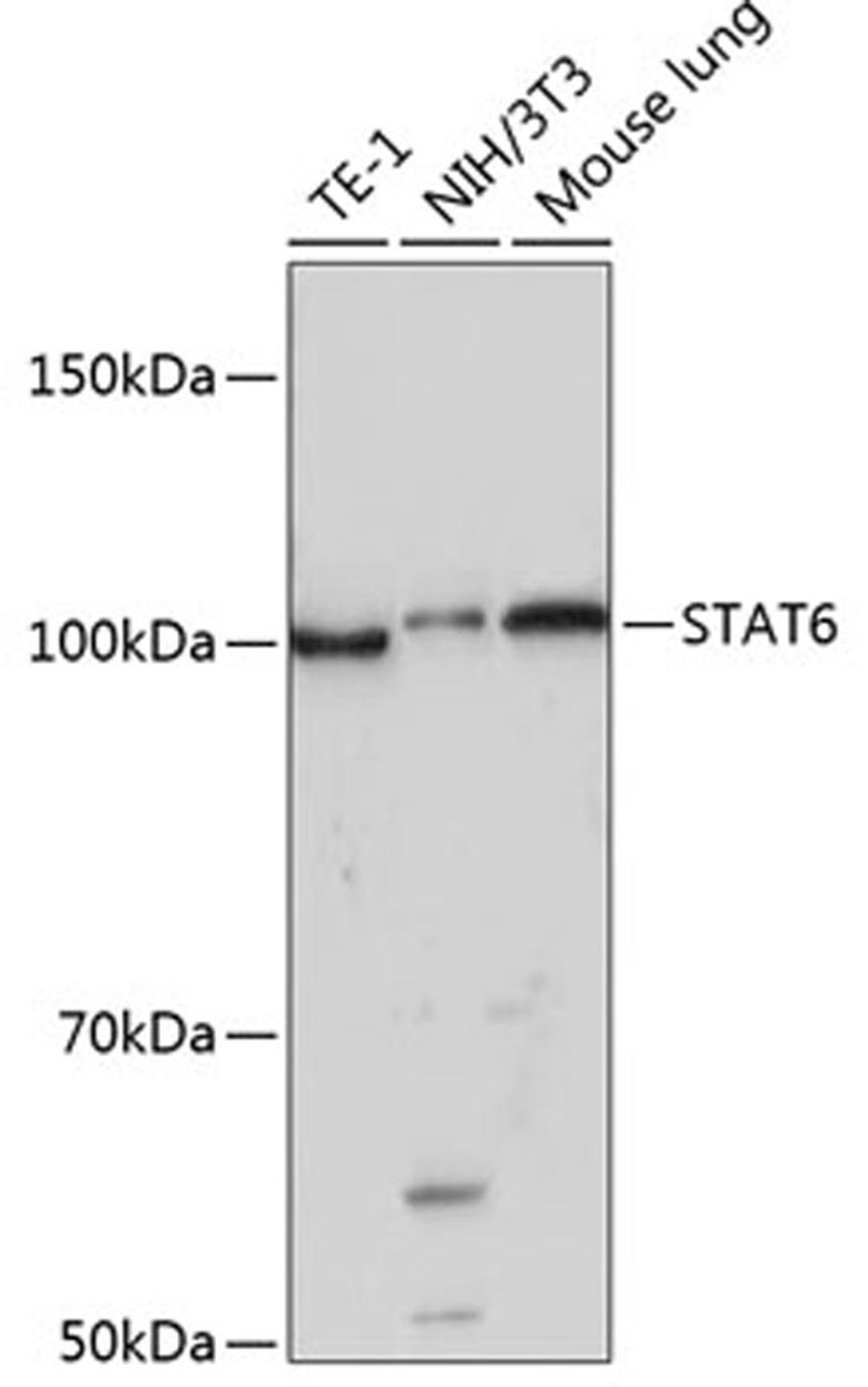 Western blot - STAT6 antibody (A19120)