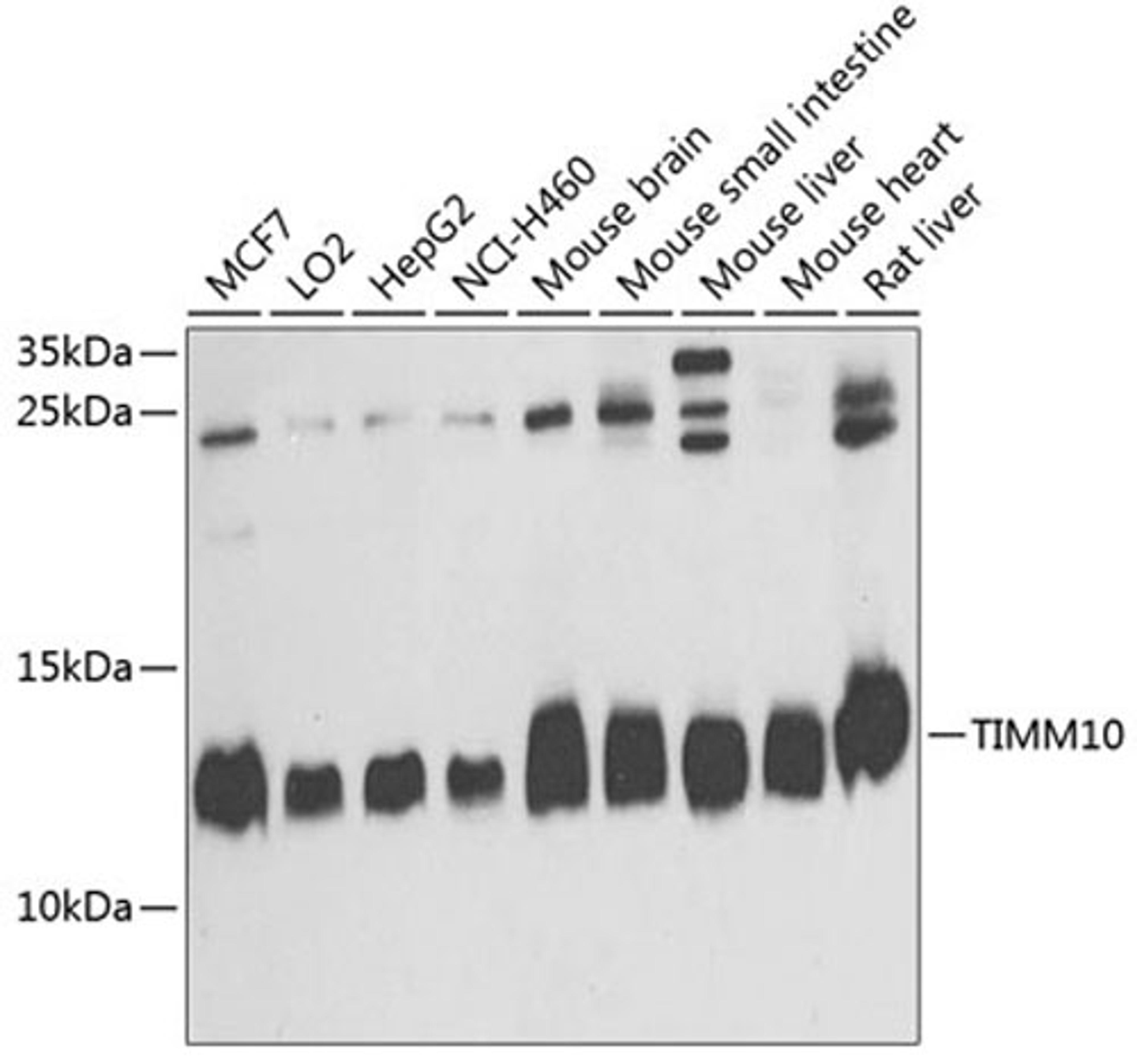 Western blot - TIMM10 antibody (A4626)