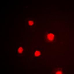 Immunofluorescense analysis of HeLa cells using p53 (phospho-S392) antibody