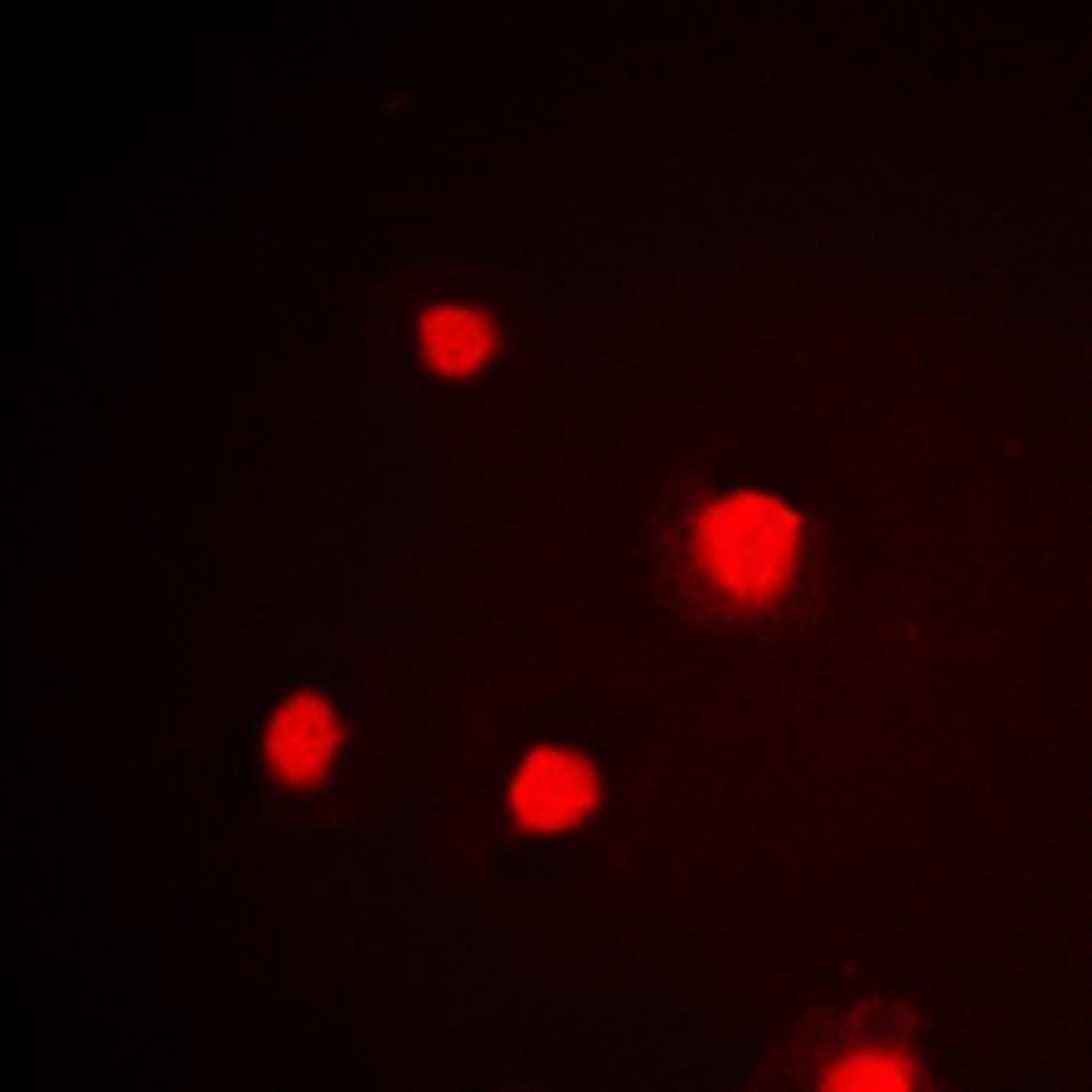 Immunofluorescense analysis of HeLa cells using p53 (phospho-S392) antibody