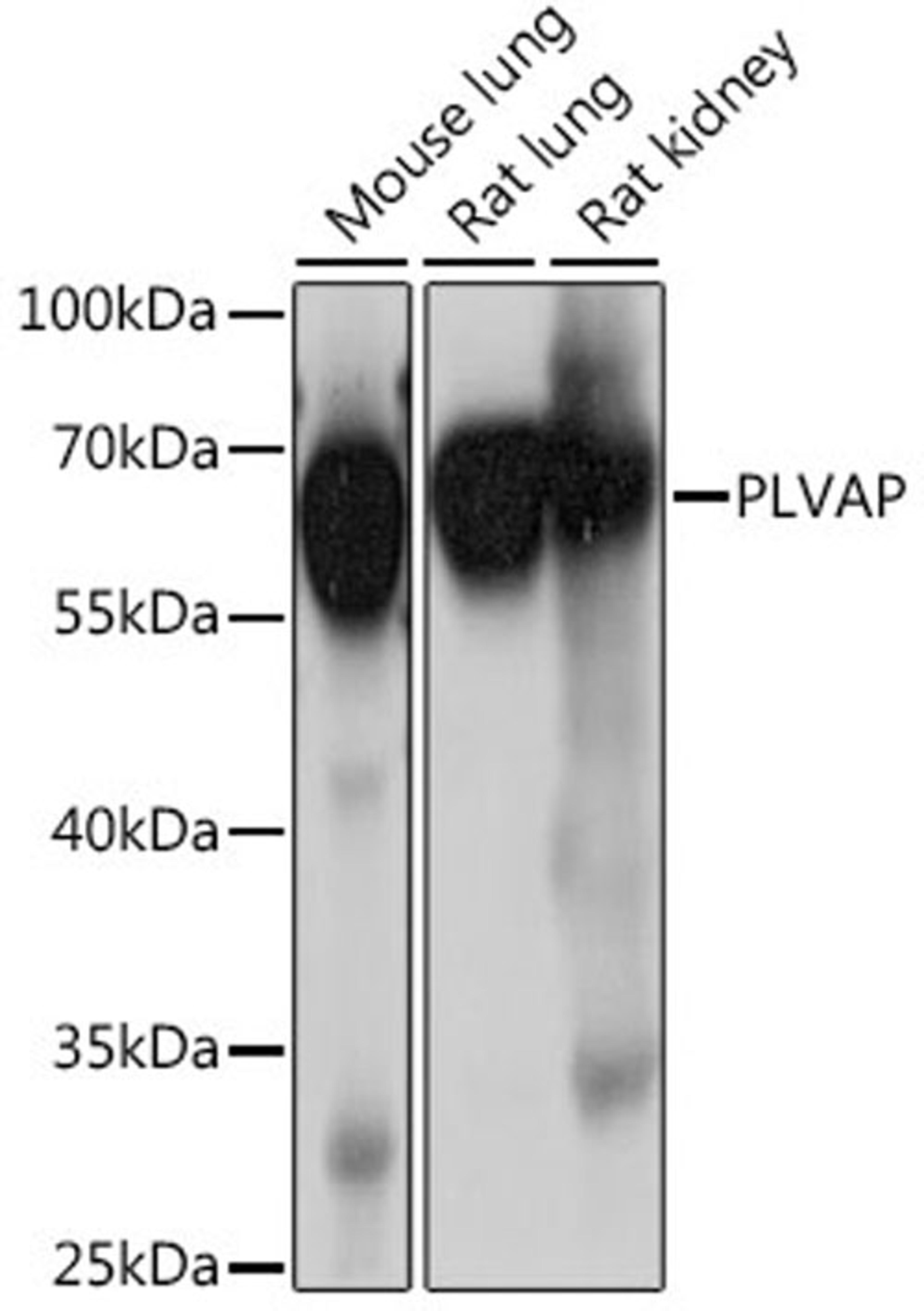 Western blot - PLVAP antibody (A15906)