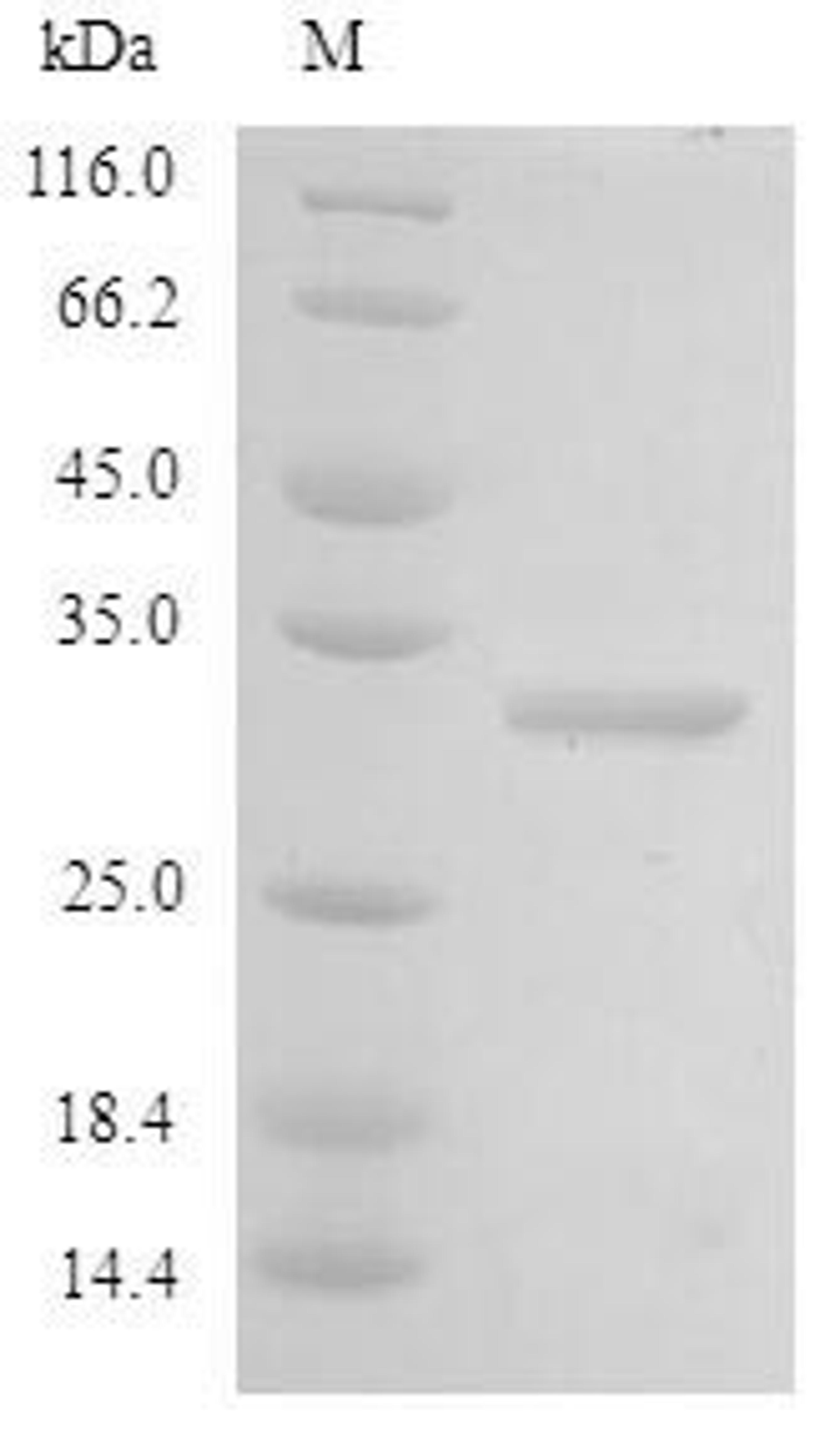 (Tris-Glycine gel) Discontinuous SDS-PAGE (reduced) with 5% enrichment gel and 15% separation gel.