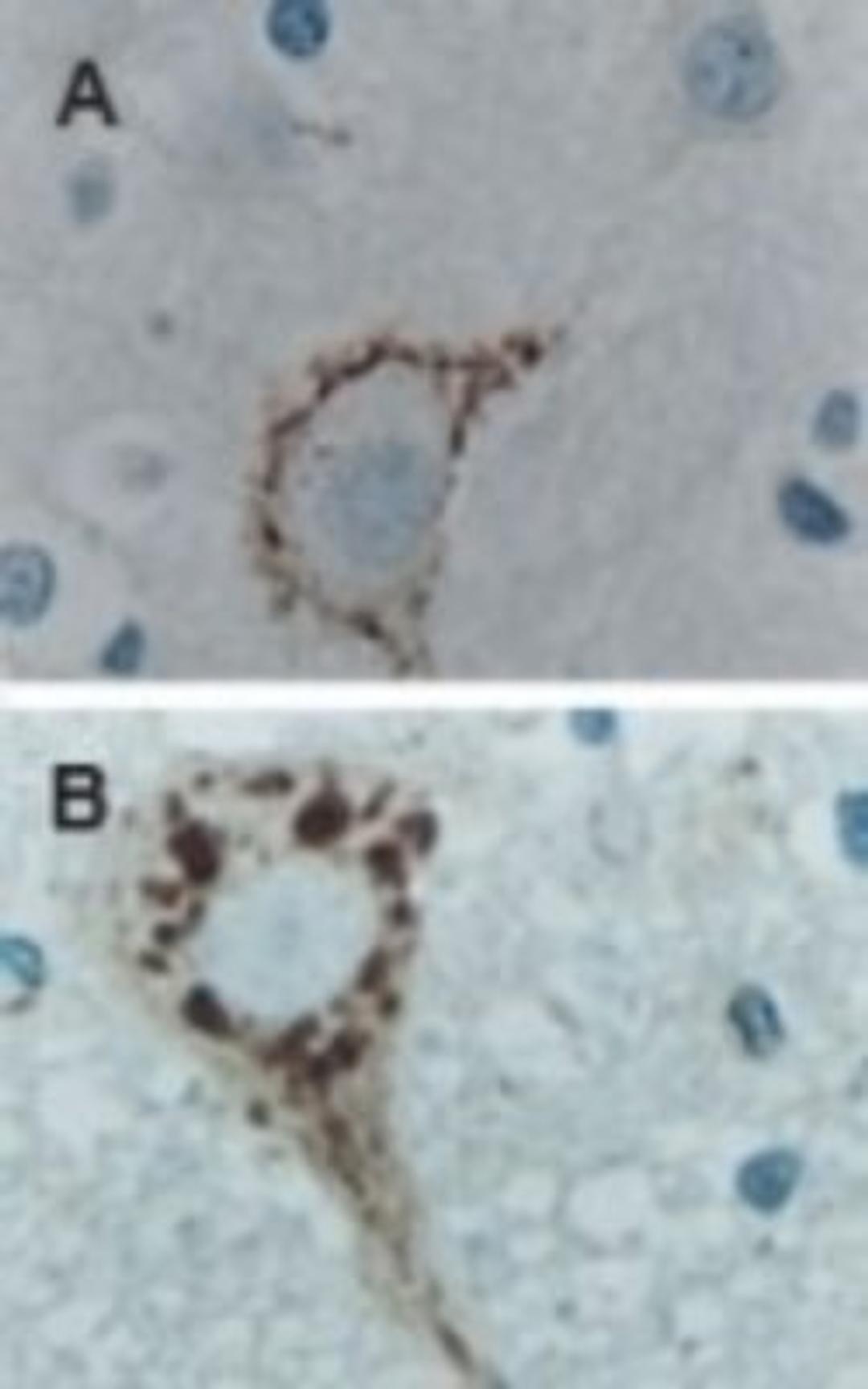 Immunohistochemistry: Caspase-9 Antibody [NB100-56119] - IHC analysis of AB expression in formalin-fixed, paraffin-embedded mouse brain tissue sections at 1:2000. Hematoxylin-eosin counterstain. A:Brain striatum, B: Brain stem motor neuron.