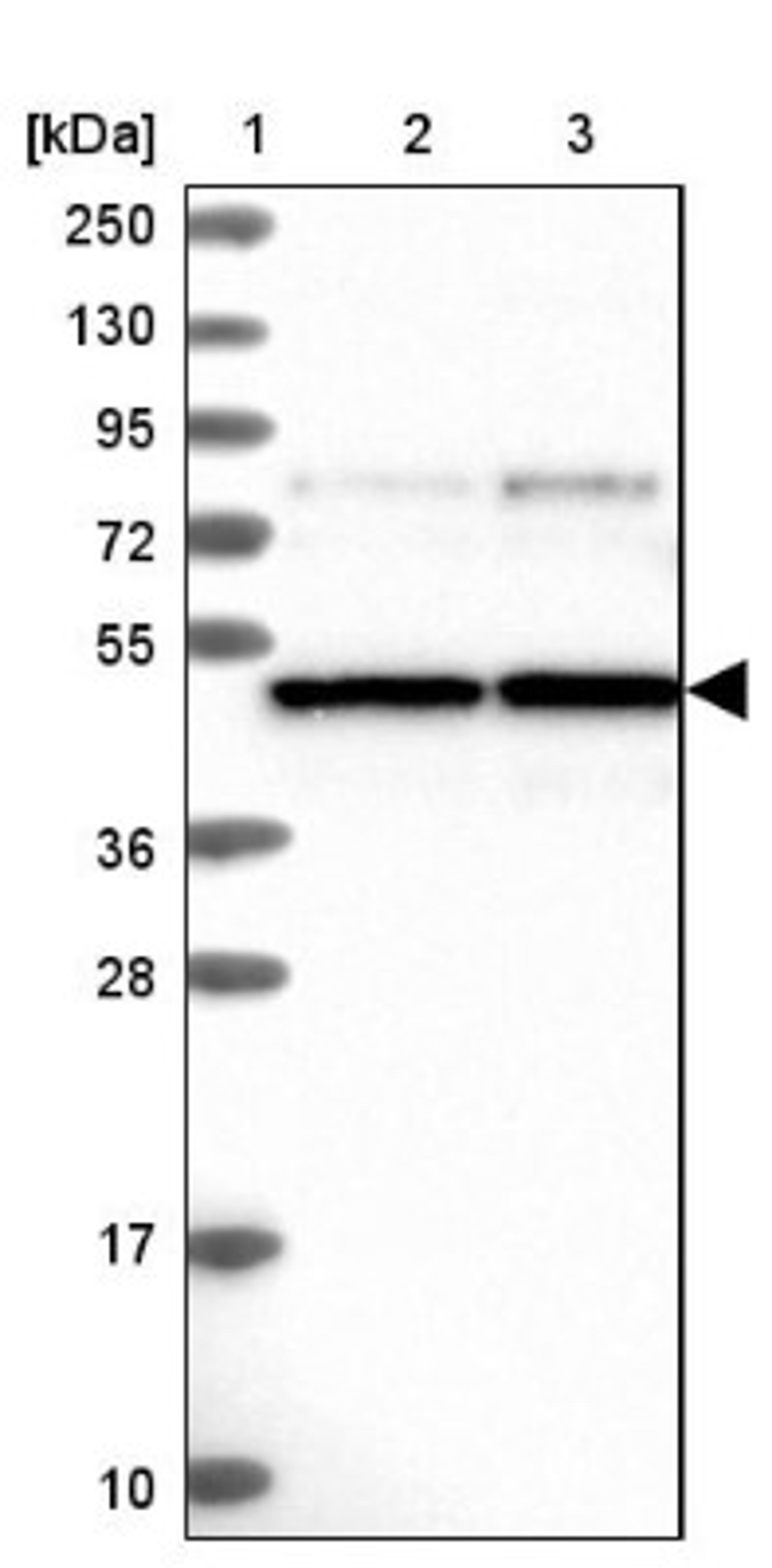 Western Blot: C15orf27 Antibody [NBP1-81939] - Lane 1: Marker [kDa] 250, 130, 95, 72, 55, 36, 28, 17, 10<br/>Lane 2: Human cell line RT-4<br/>Lane 3: Human cell line U-251MG sp