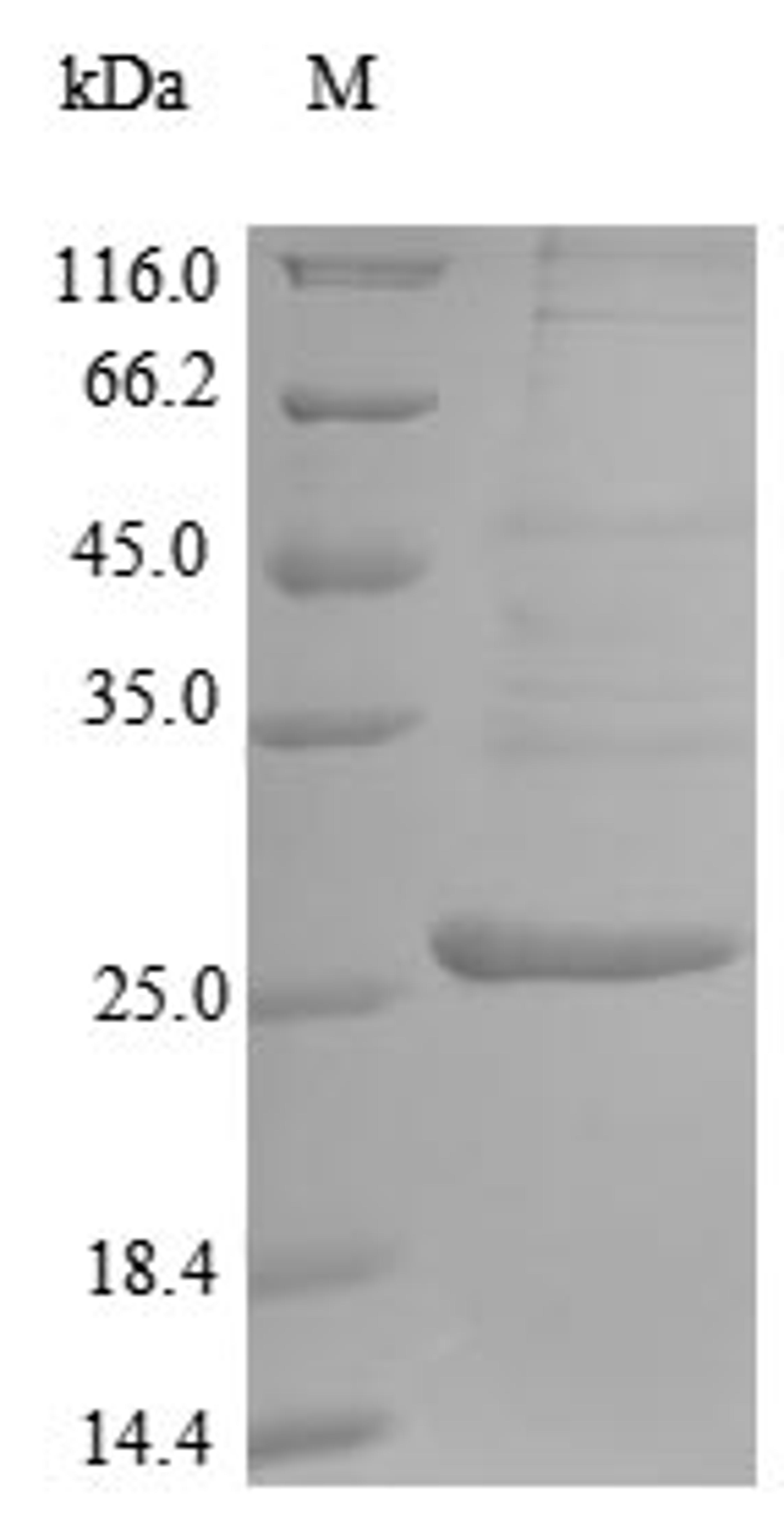 (Tris-Glycine gel) Discontinuous SDS-PAGE (reduced) with 5% enrichment gel and 15% separation gel.