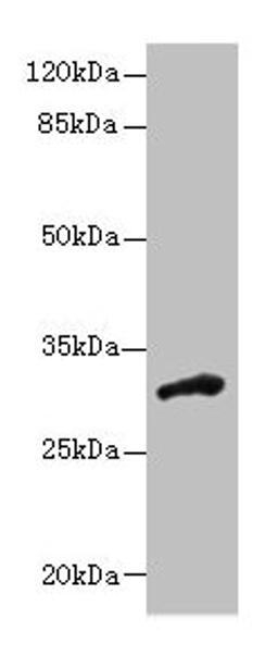 Western blot. All lanes: DHRS12 antibody at 1.3µg/ml + Human placenta tissue. Secondary. Goat polyclonal to rabbit IgG at 1/10000 dilution. Predicted band size: 36, 28, 31 kDa. Observed band size: 31 kDa