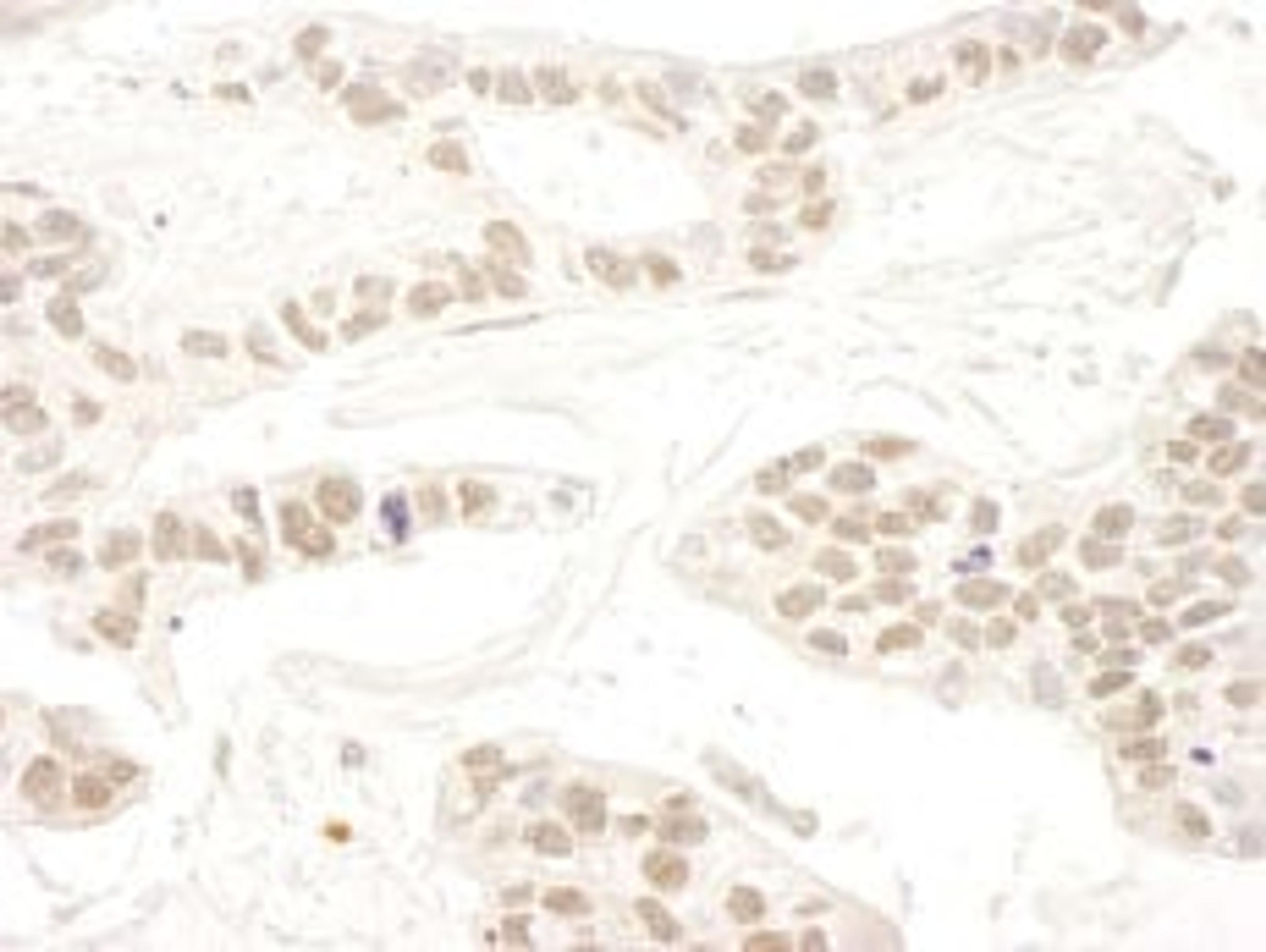 Detection of human RBM34 by immunohistochemistry.