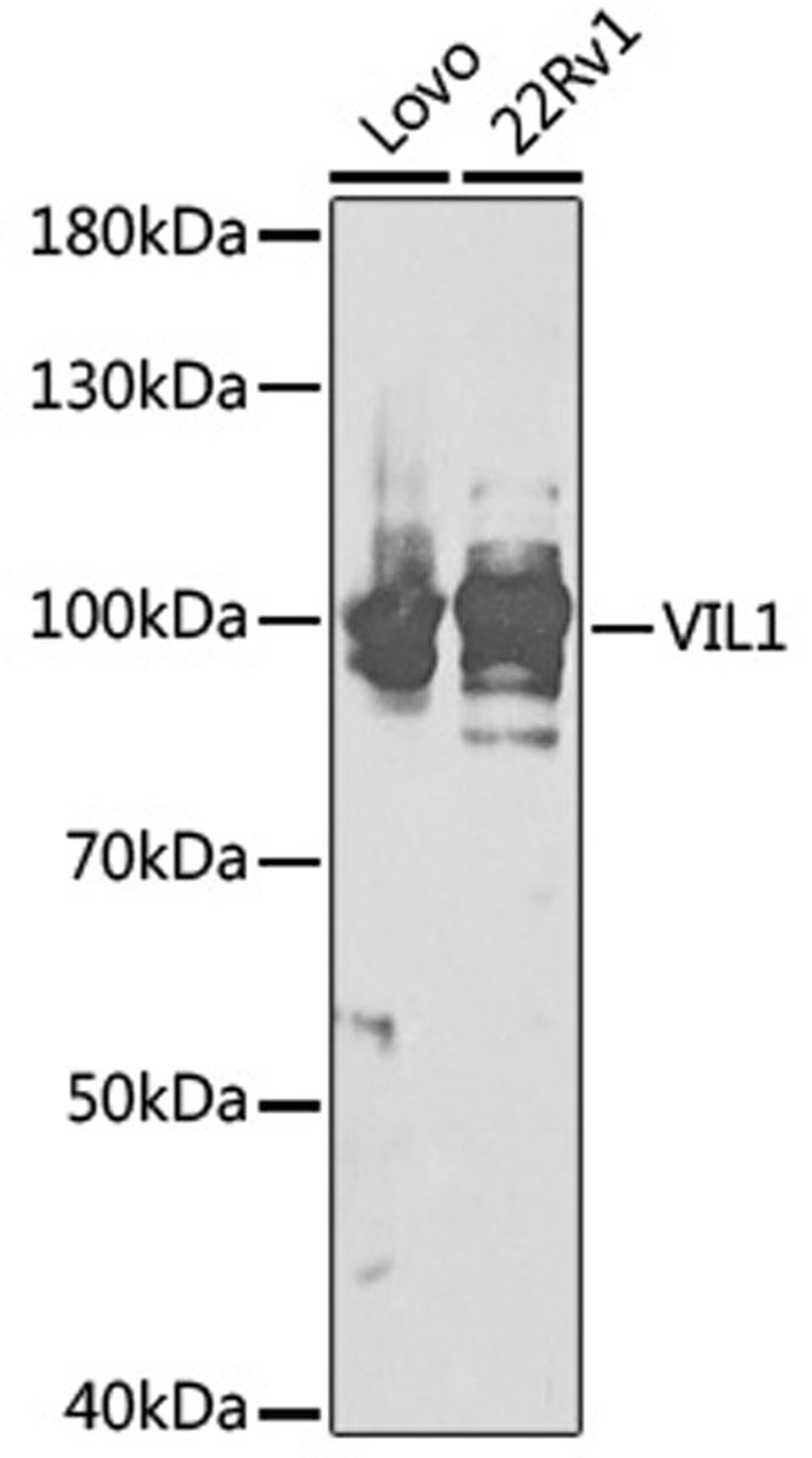 Western blot - VIL1 antibody (A17002)