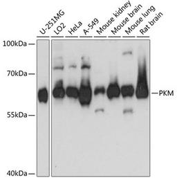 Western blot - PKM antibody (A13905)