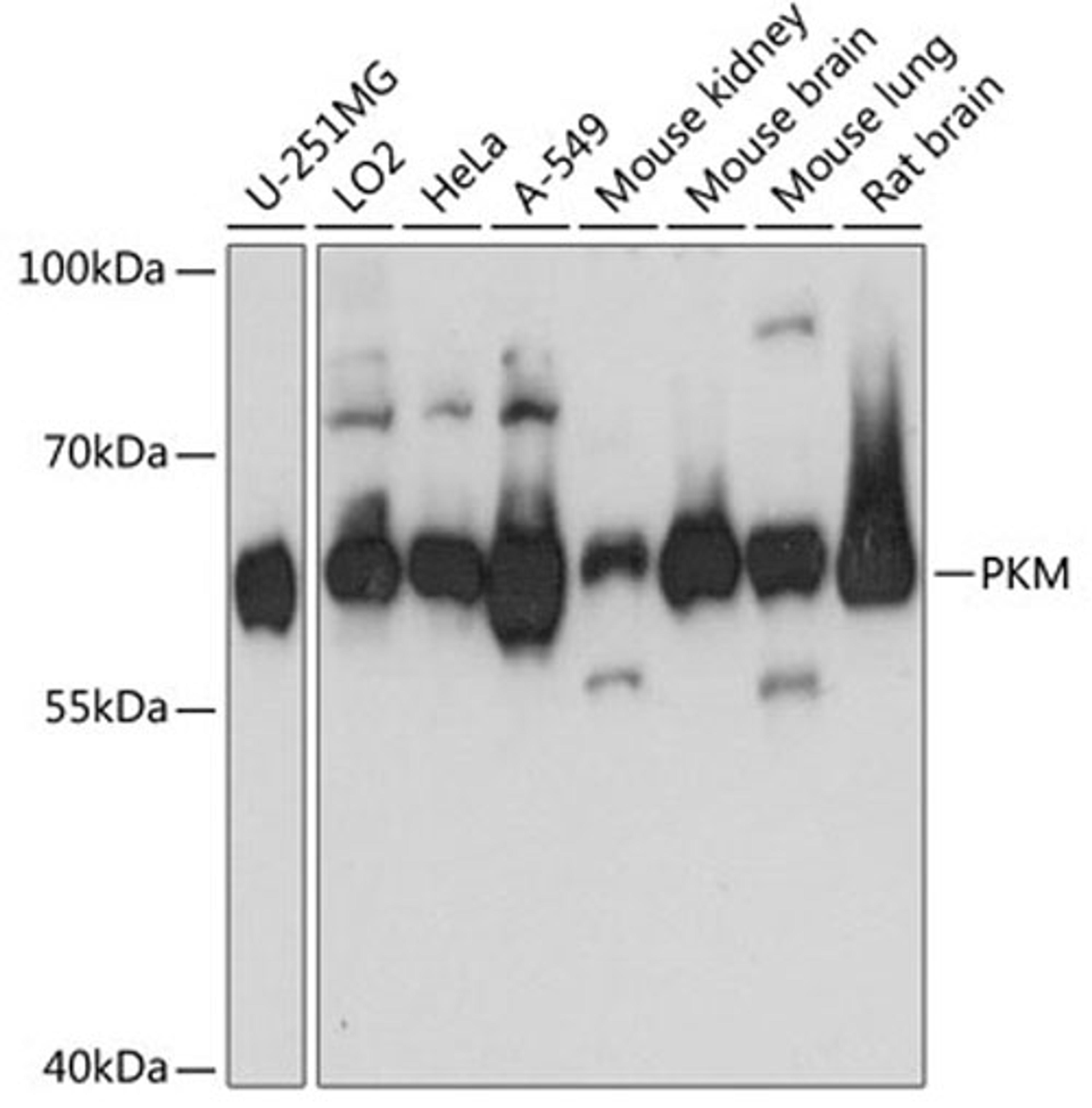 Western blot - PKM antibody (A13905)