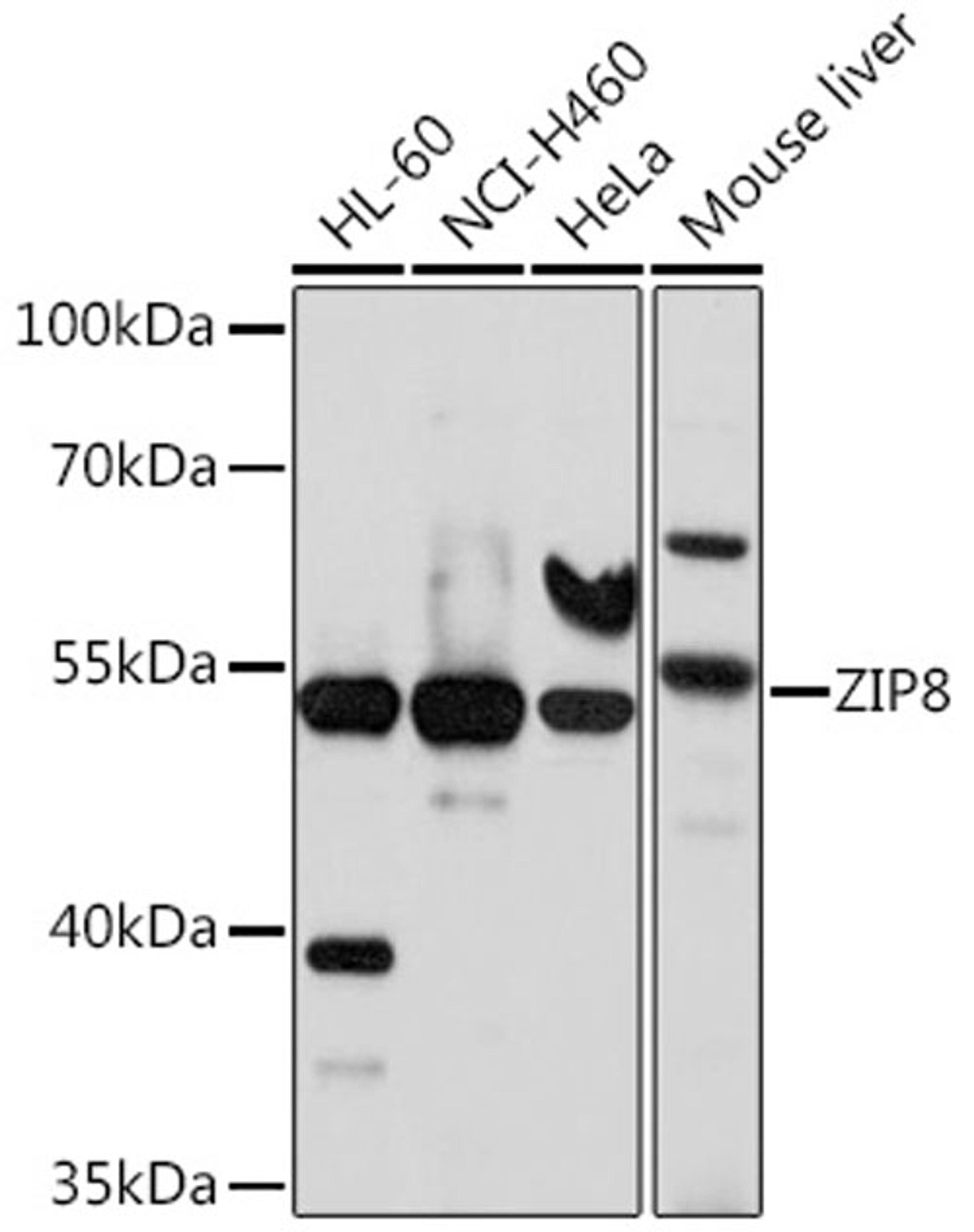 Western blot - ZIP8 antibody (A10395)