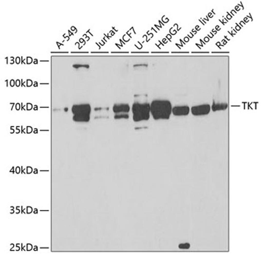 Western blot - TKT antibody (A6314)