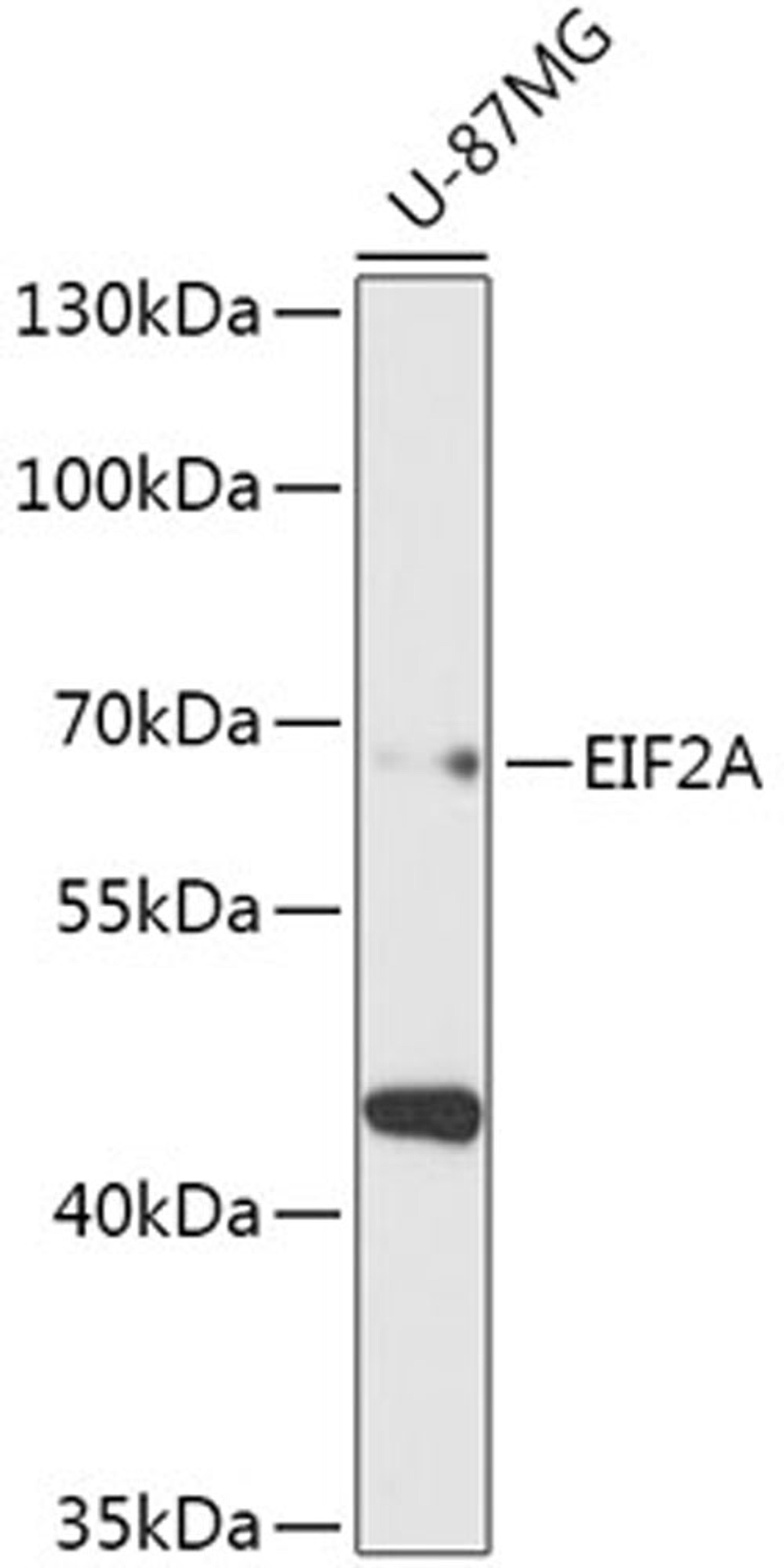 Western blot - EIF2A antibody (A16205)