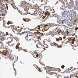 Immunohistochemistry-Paraffin: C1q Antibody [NBP1-87492] - Staining of human lung shows strong cytoplasmic positivity in macrophages.