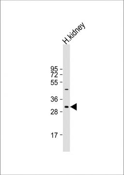 Western Blot at 1:1000 dilution + human kidney lysate Lysates/proteins at 20 ug per lane.