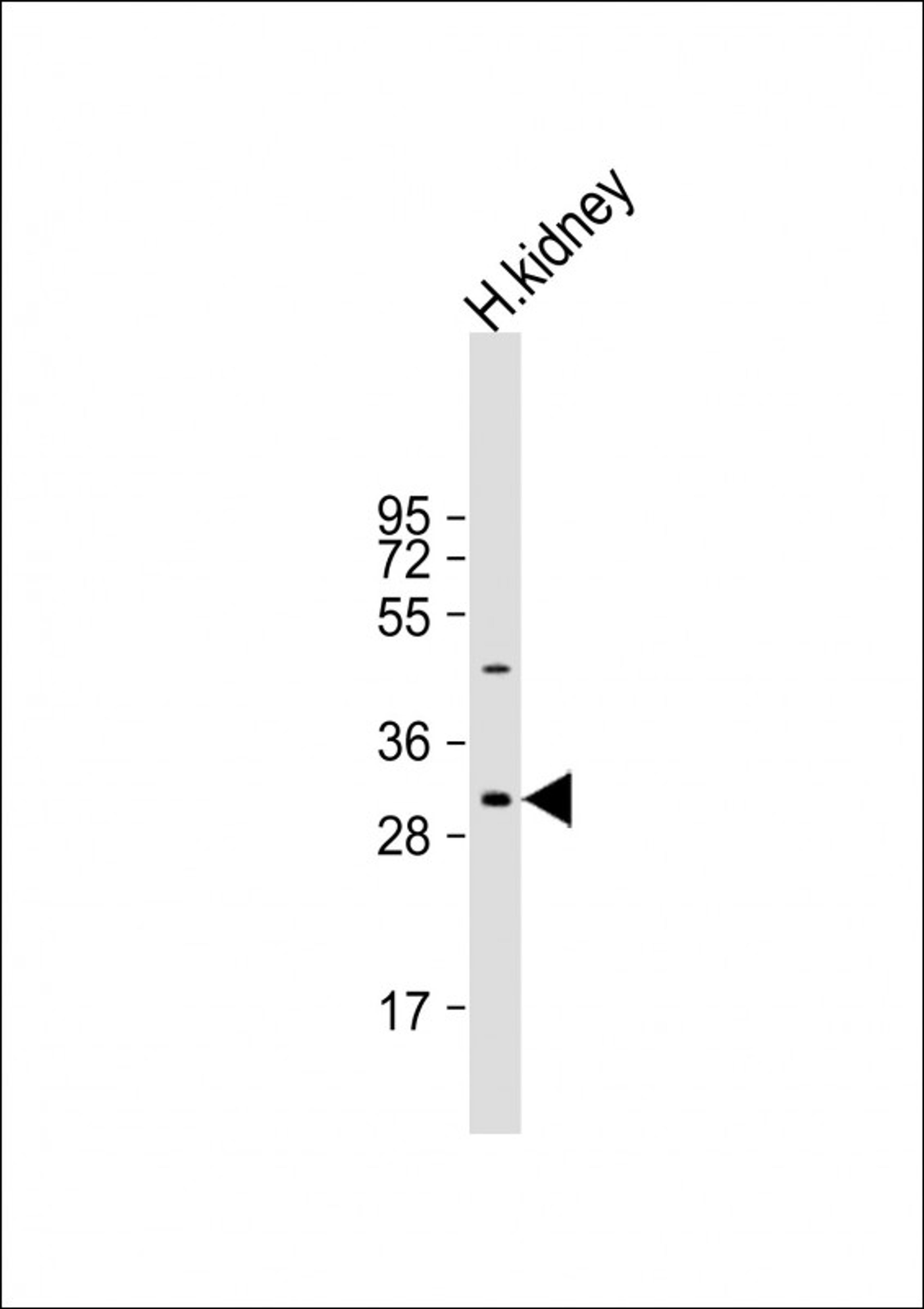 Western Blot at 1:1000 dilution + human kidney lysate Lysates/proteins at 20 ug per lane.