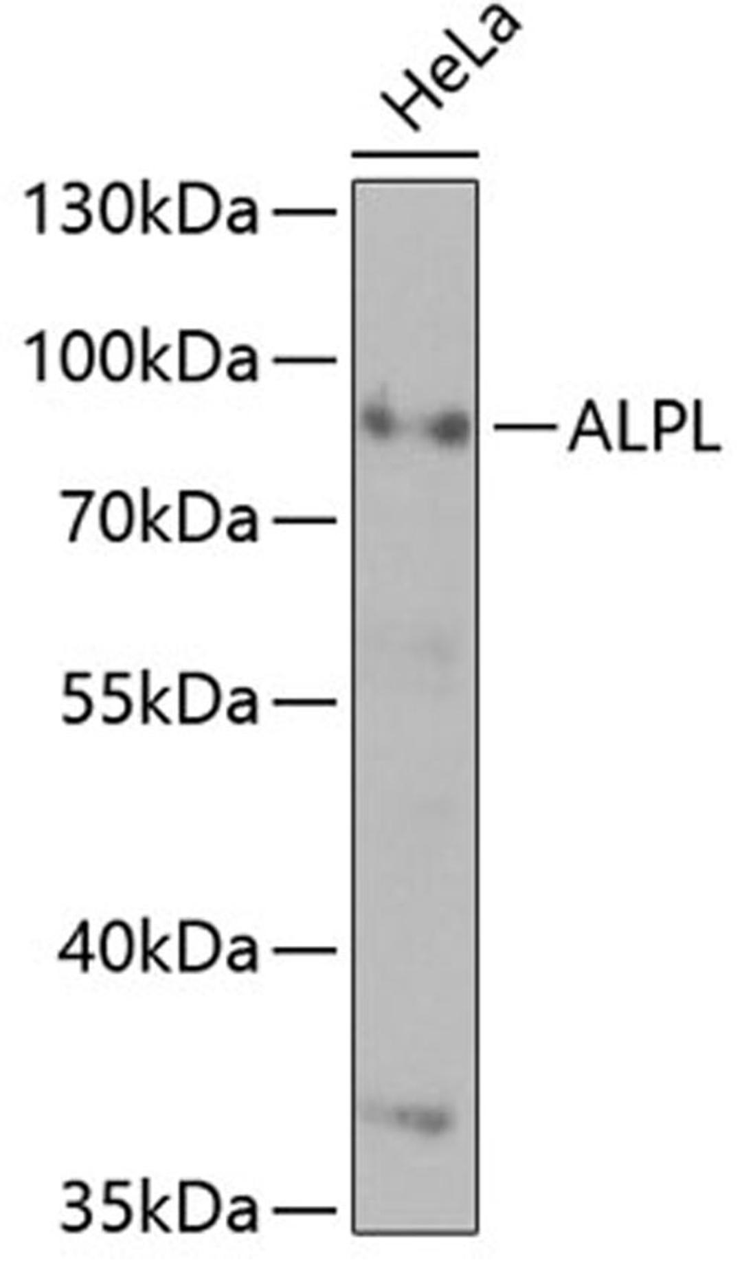 Western blot - ALPL antibody (A1080)