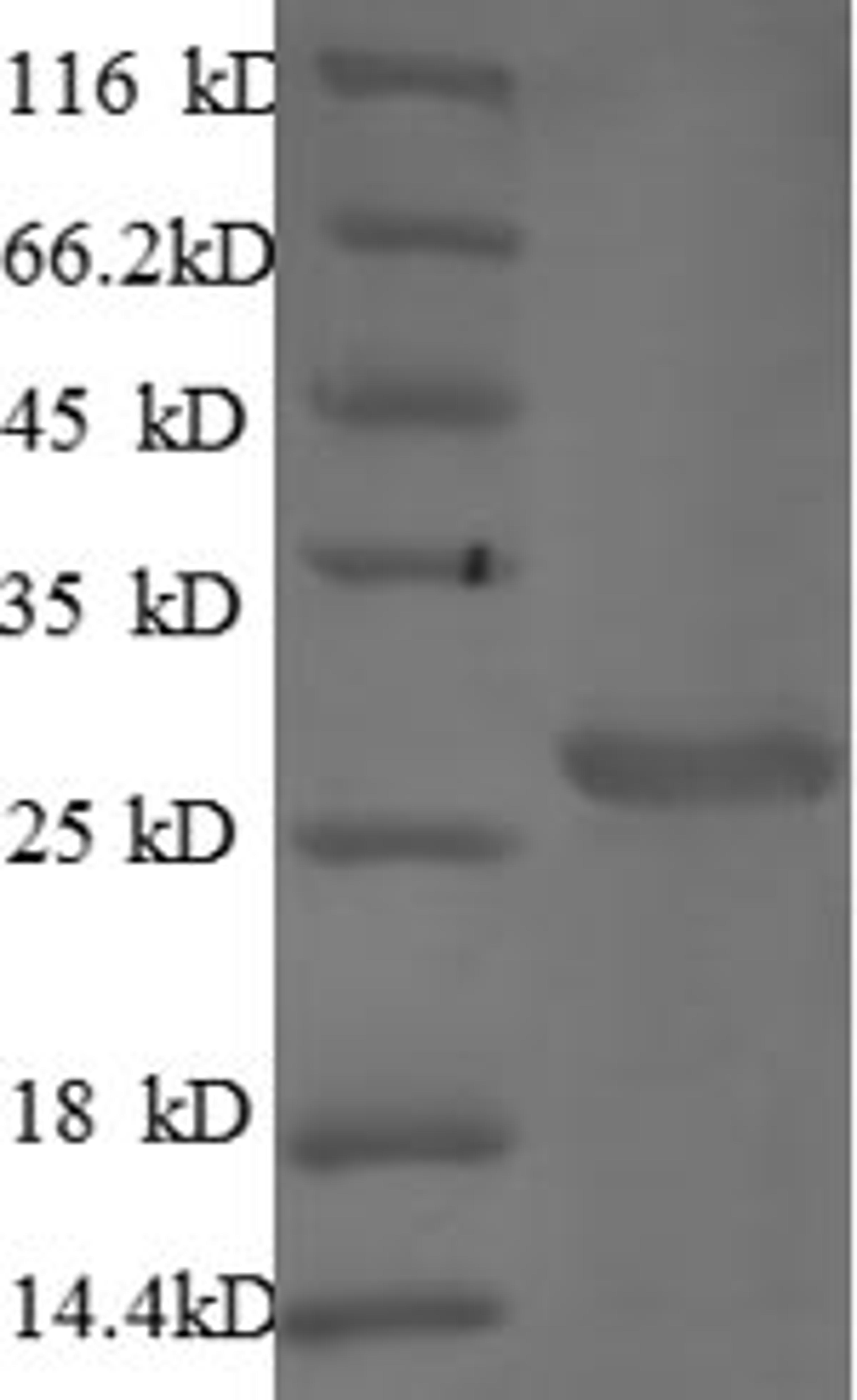 (Tris-Glycine gel) Discontinuous SDS-PAGE (reduced) with 5% enrichment gel and 15% separation gel.