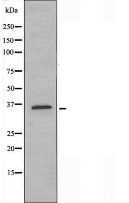 Western blot analysis of Jurkat cells using OR52N1 antibody