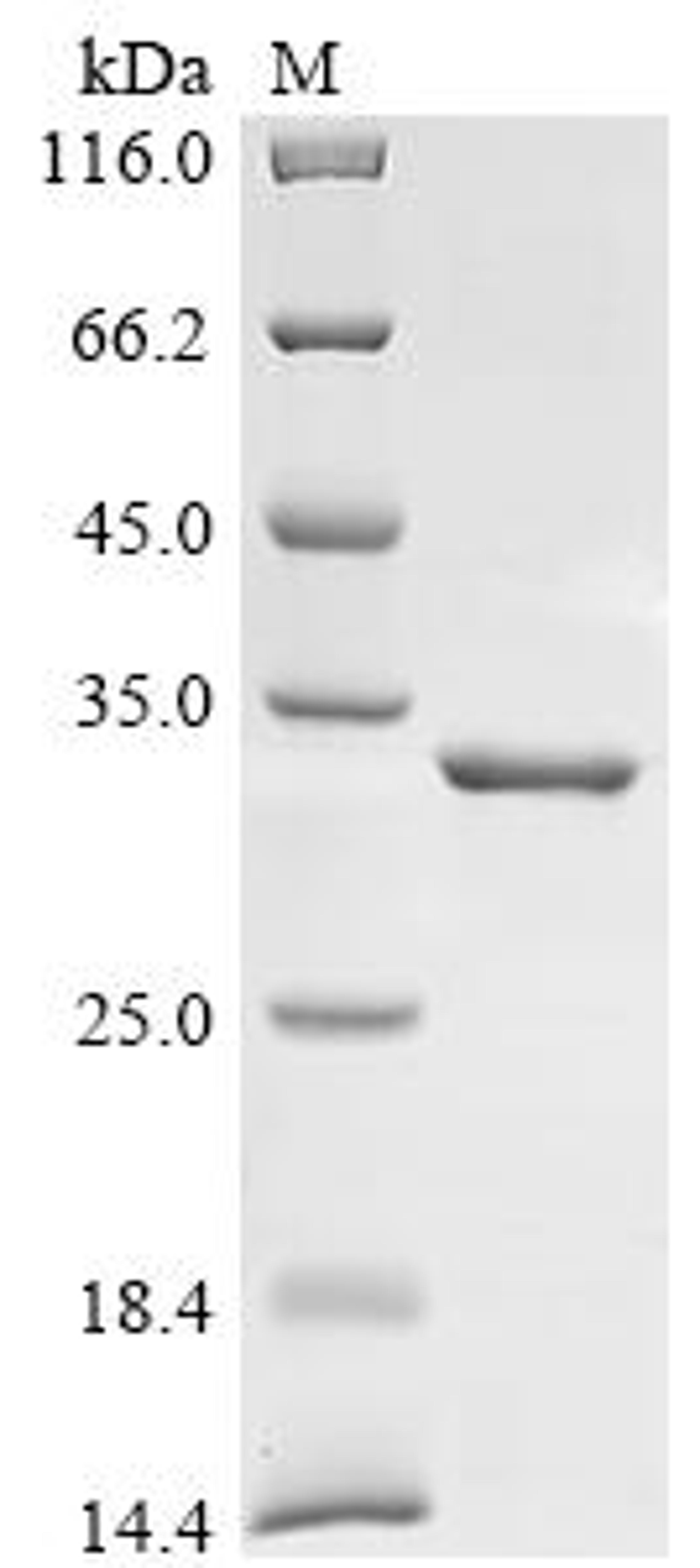 (Tris-Glycine gel) Discontinuous SDS-PAGE (reduced) with 5% enrichment gel and 15% separation gel.