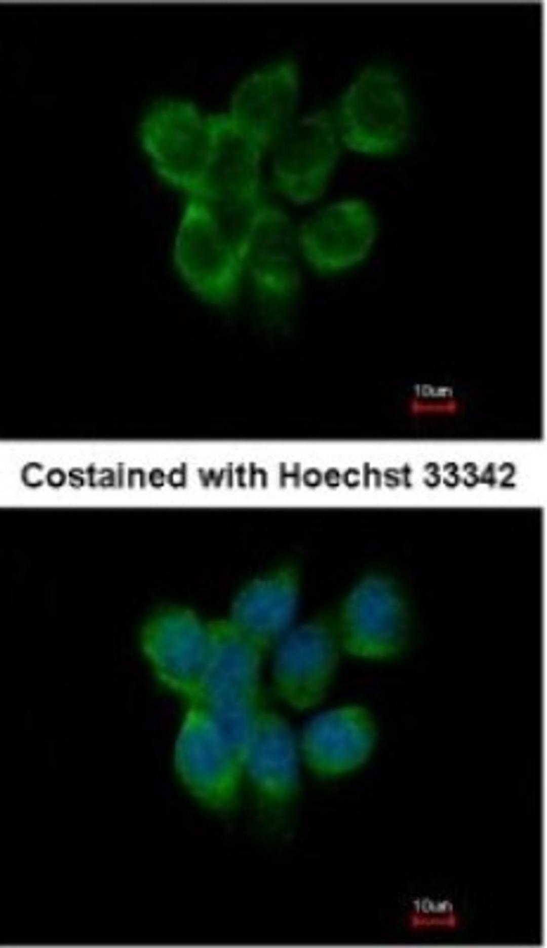 Immunocytochemistry/Immunofluorescence: APOBEC3F Antibody [NBP2-15426] - Paraformaldehyde-fixed A431, using antibody at 1:500 dilution.