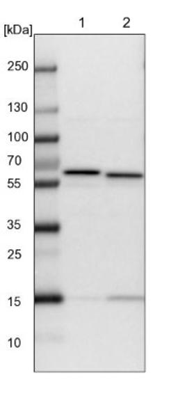 Western Blot: CCT8 Antibody [NBP1-88285] - Lane 1: NIH-3T3 cell lysate (Mouse embryonic fibroblast cells)<br/>Lane 2: NBT-II cell lysate (Rat Wistar bladder tumour cells)