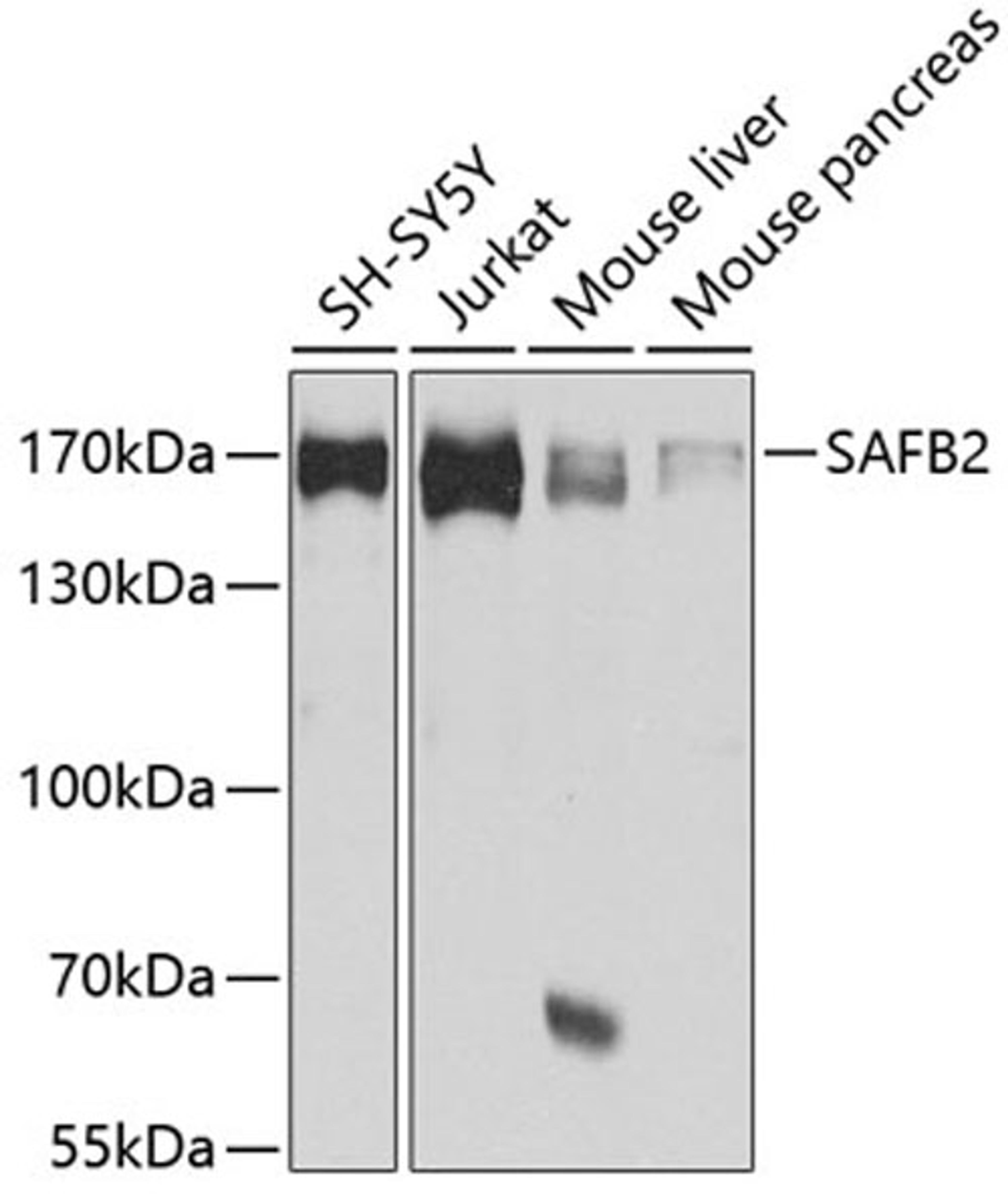 Western blot - SAFB2 antibody (A4330)