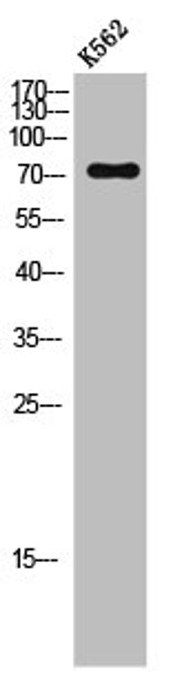 Western Blot analysis of K562 cells using LIMK-1 Polyclonal Antibody