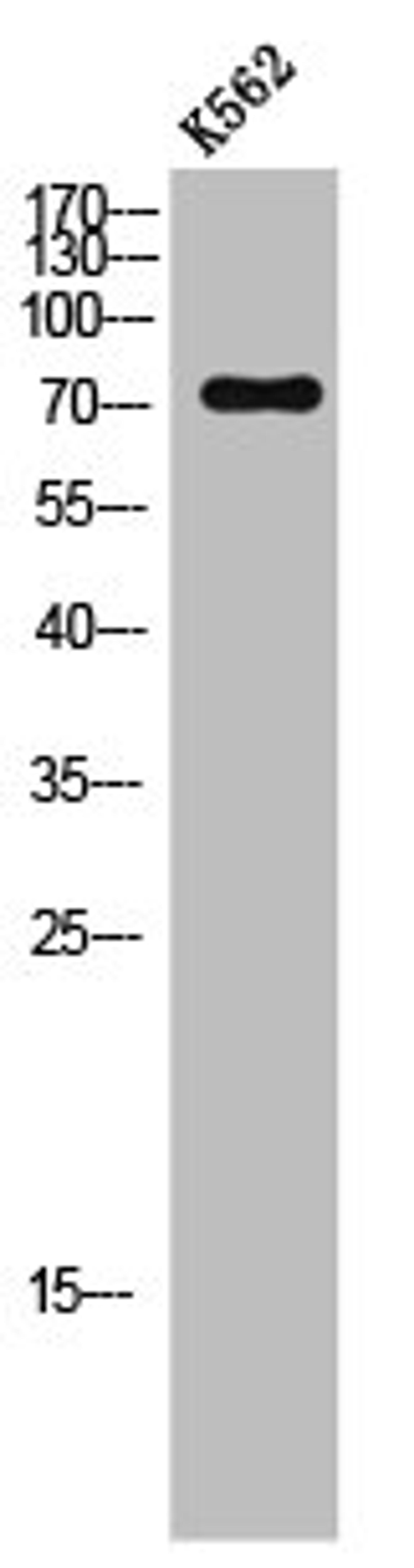 Western Blot analysis of K562 cells using LIMK-1 Polyclonal Antibody