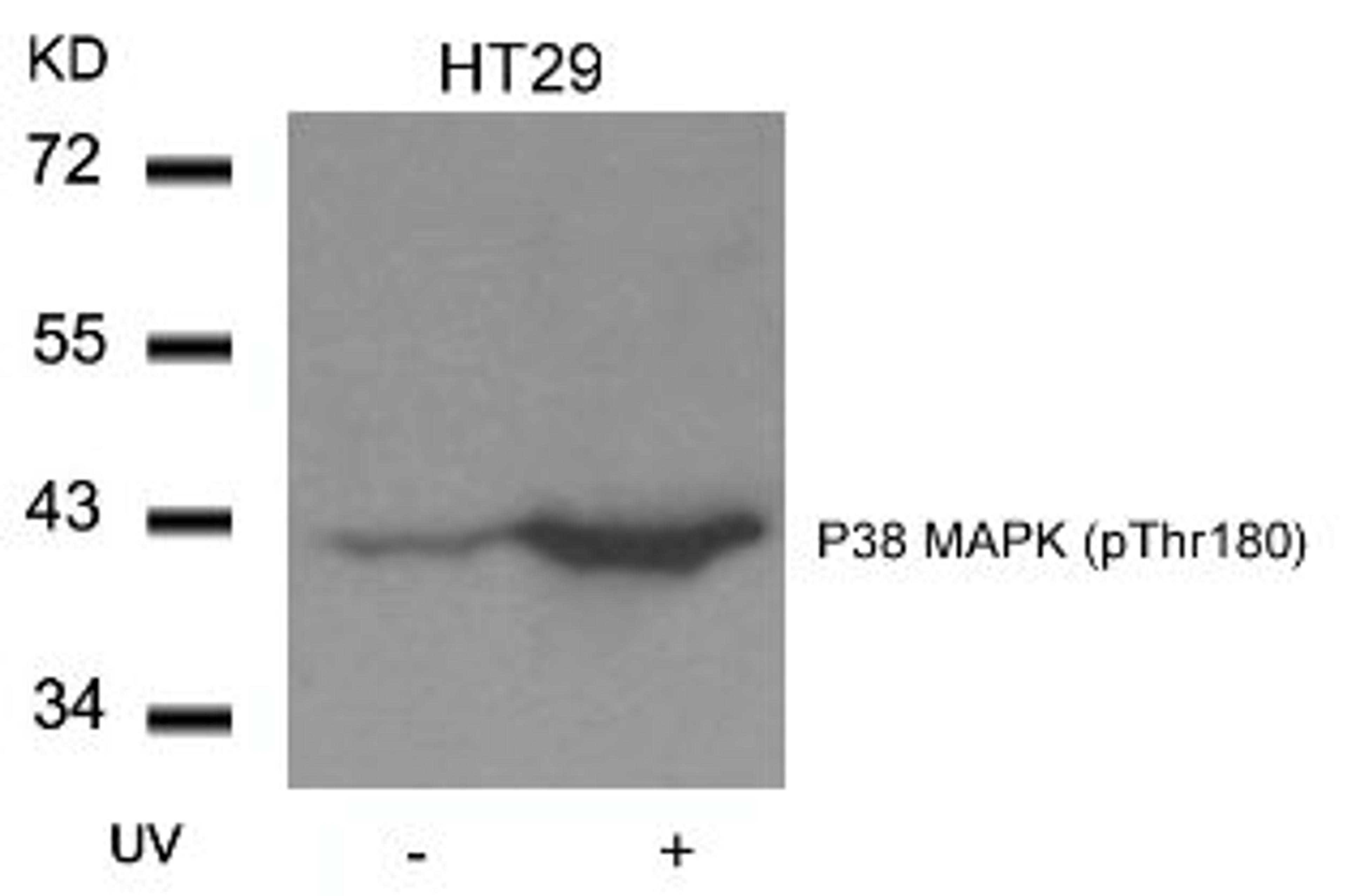 Western blot analysis of lysed extracts from HT29 cells untreated or treated with UV using P38 MAPK (Phospho-Thr180).