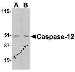 Western blot analysis of caspase-12 in (A) human and (B) mouse spleen tissue lysates with caspase-12 antibody at 1 μg/mL.