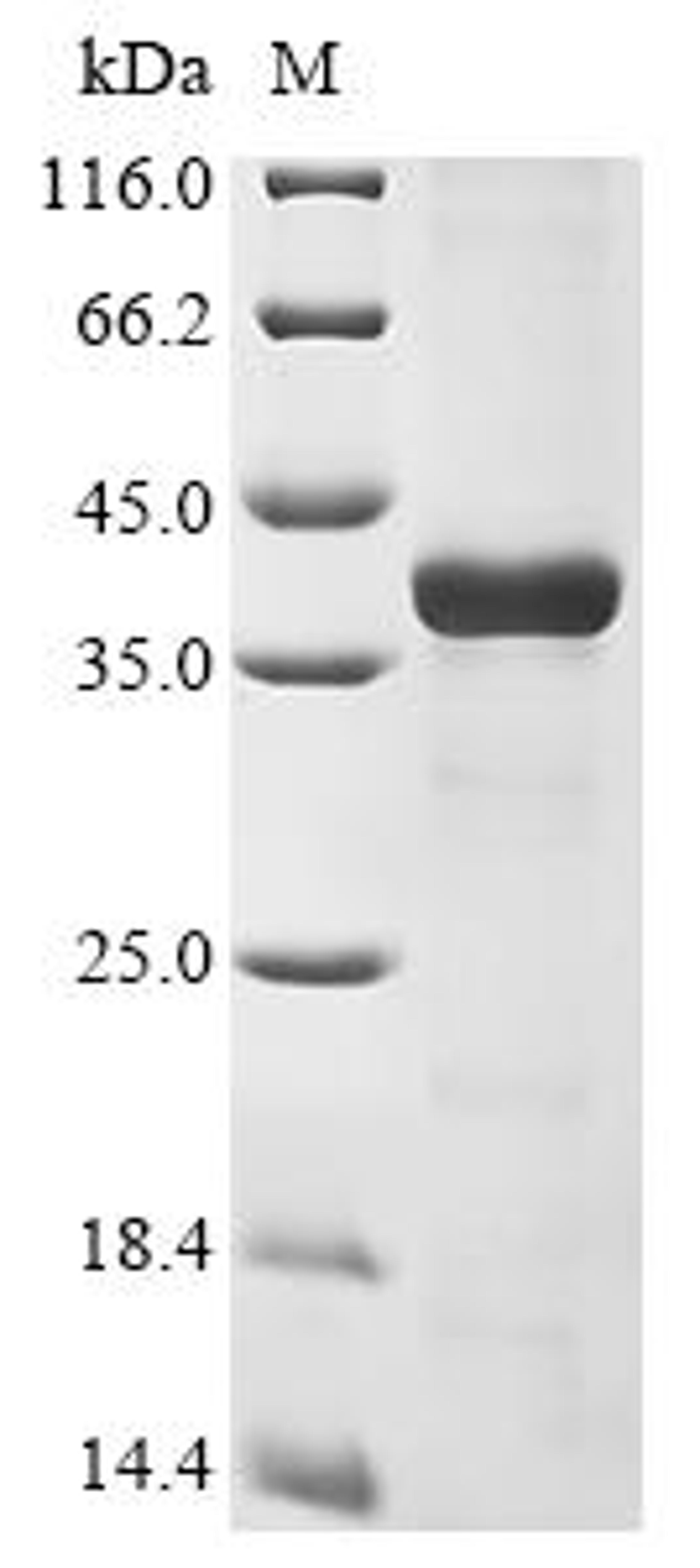 (Tris-Glycine gel) Discontinuous SDS-PAGE (reduced) with 5% enrichment gel and 15% separation gel.