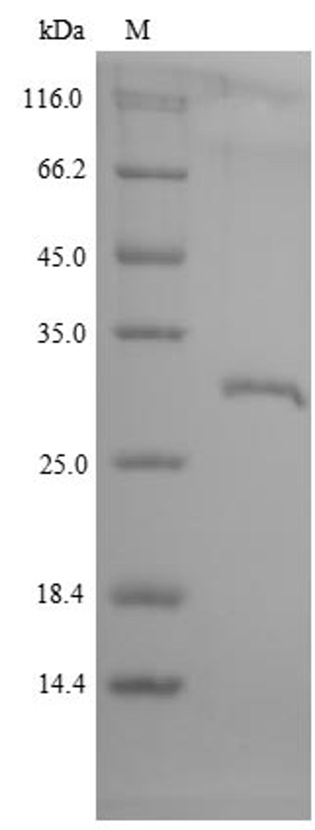 (Tris-Glycine gel) Discontinuous SDS-PAGE (reduced) with 5% enrichment gel and 15% separation gel.