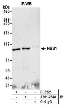 Detection of mouse NBS1 by western blot of immunoprecipitates.