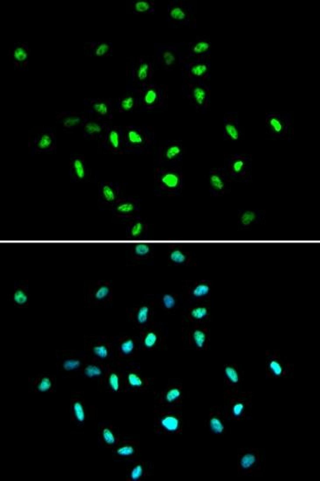 Immunofluorescense analysis of A549 cell using HDAC1 antibody