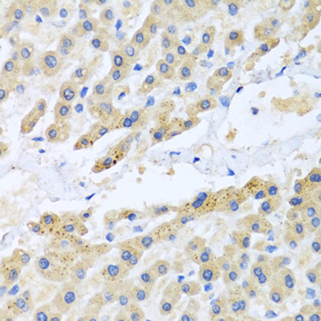 Immunohistochemistry  - CCL3 antibody (A7568)