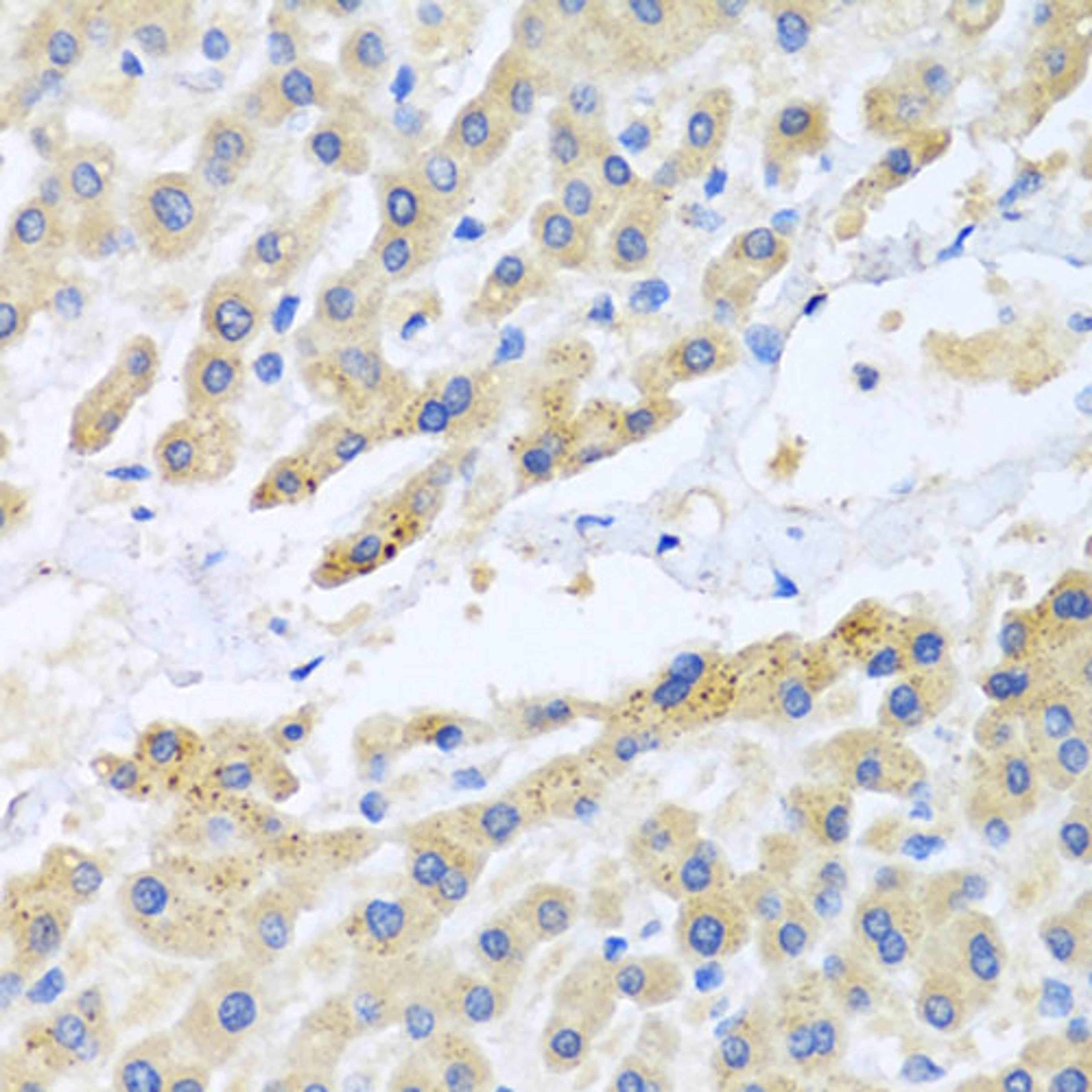 Immunohistochemistry  - CCL3 antibody (A7568)