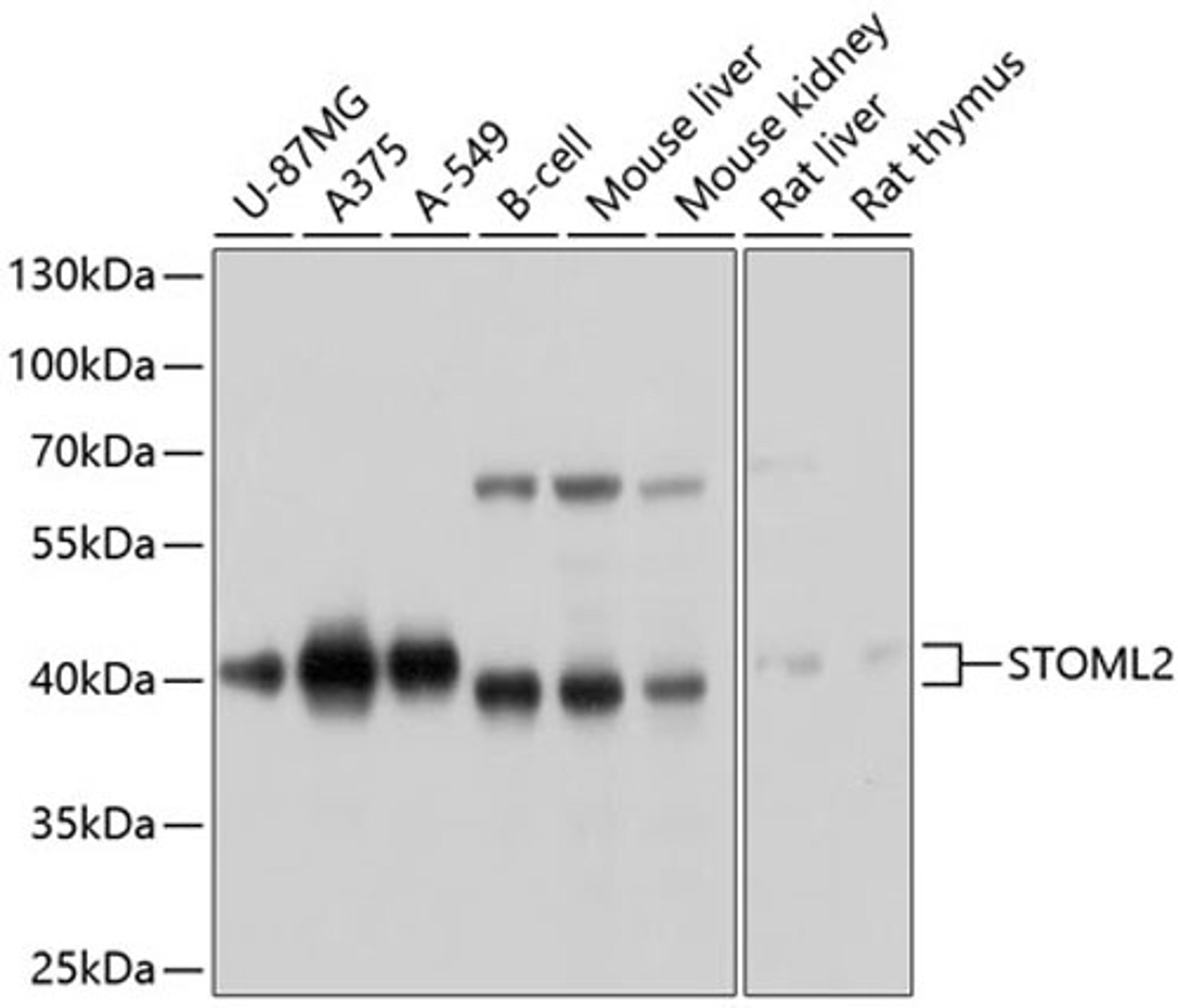 Western blot - STOML2 antibody (A10398)